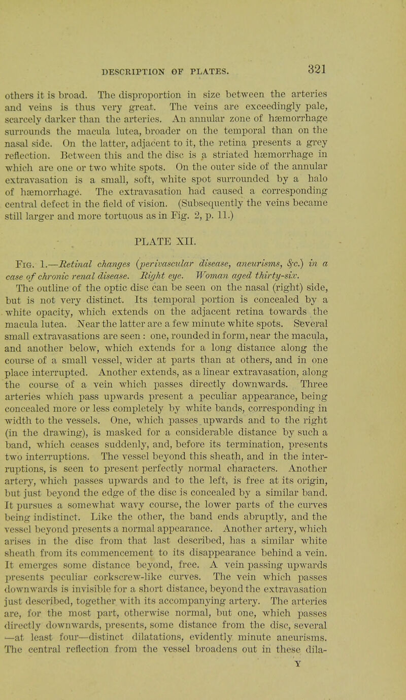 DESCRIPTION OF PLATES. others it is broad. The disproportion in size between the arteries and veins is thus veiy great. The veins are exceedingly pale, scarcely darker than the arteries. An annular zone of hseraorrhage surrounds the macula lutea, broader on the temporal than on the nasal side. On the latter, adjacent to it, the retina presents a grey reflection. Between this and the disc is a striated hfemorrhage in which are one or two white spots. On the outer side of the annular extravasation is a small, soft, white spot surrounded by a halo of hiemorrhage. The extravasation had caused a corresponding central defect in the field of vision. (Subsequently the veins became still larger and more tortuous as in Fig. 2, p. 11.) PLATE XII. Fig. 1.—Retinal changes {jperivascular disease, aneurisons, Sfc.) in a case of chronic renal disease. Right eye. Woman aged thirty-six. The outline of the optic disc can be seen on the nasal (right) side, but is not very distinct. Its temporal portion is concealed by a white opacity, which extends on the adjacent retina towards the macula lutea. Xear the latter are a few minute white spots. Several small extravasations are seen : one, rounded in form, near the macula, and another below, which extends for a long distance along the course of a small ■vessel, wider at parts than at others, and in one place interrupted. Another extends, as a linear extravasation, along the course of a vein which passes directly downwards. Three arteries wliich pass upwards present a pecuhar appearance, being concealed more or less completely by white bands, corresponding in width to the vessels. One, which passes upwards and to the right (in the drawing), is masked for a considerable distance by such a band, which ceases suddenly, and, before its termination, presents two interruptions. The vessel beyond this sheath, and in the inter- ruptions, is seen to present perfectly normal characters. Another artery, which passes uiiwards and to the left, is free at its origin, but just beyond the edge of the disc is concealed by a similar band. It pursues a somewhat wavy course, the lower parts of the curves being indistinct. Like the other, the band ends abruptly, and the vessel beyond presents a normal appearance. Another artery, which arises in the disc from that last described, has a similar white sheath from its commencement to its disappearance behind a vein. It emerges some distance beyond, free. A vein passing upwards presents peculiar corkscrew-like curves. The vein which passes downwards is invisible for a short distance, beyond the extravasation just described, together with its accompanying artery. The arteries are, for the most part, otherwise normal, but one, which passes directly downwards, presents, some distance from the disc, several '—at least four—distinct dilatations, evidently minute aneurisms. The central reflection from the vessel broadens out in tliesc dila- Y