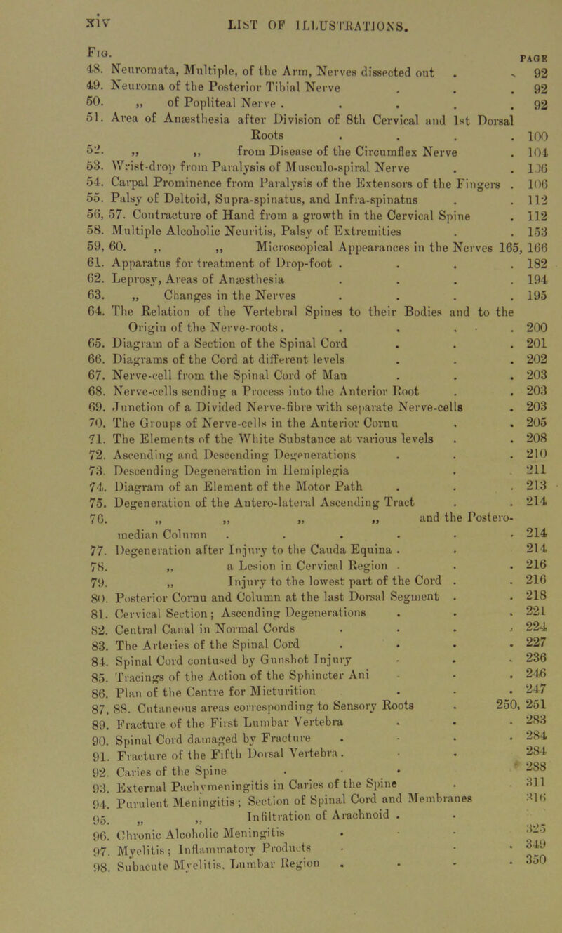 Fig. 4S. Neuromata, Multiple, of the Arm, Nerves dissected out 49. Neuroma of the Posterior Tibial Nerve 50. „ of Popliteal Nerve . 51. Area of Anmsthesia after Division of 8th Cervical and 1st Dorsal Roots . >j ,, from Disease of the Circumflex Nerve Wrist-drop from Paralysis of Musculo-spiral Nerve Carpal Prominence from Paralysis of the Extensors of the Fingers . 55. Palsy of Deltoid, Supra-spinatus, and Infra-spinatus 56, 57. Contracture of Hand from a growth in the Cervical Spine 58. Multiple Alcoholic Neuritis, Palsy of Extremities 52. 53. 54. 59, 60. 61. 62. 63. 64. 65. 66. 67. 68. 69. 70. 71. 72. 73. 74,. 75. 76. PAGE 92 92 92 100 104 136 106 112 112 153 Microscopical Appearances in the Nerves 165, 166 Apparatus for treatment of Drop-foot .... 182 Leprosy, Areas of Anaesthesia .... 194 „ Changes in the Nerves .... 195 The Relation of the Vertebral Spines to their Bodies and to the Origin of the Nerve-roots. . . . 200 Diagram of a Section of the Spinal Cord . . . 201 Diagrams of the Cord at different levels . . . 202 Nerve-cell from the Spinal Cord of Man . . . 203 Nerve-cells sending a Process into the Anterior Root . . 203 Junction of a Divided Nerve-fibre with separate Nerve-cells . 203 The Groups of Nerve-cells in the Anterior Cornu . . 205 The Elements of the White Substance at various levels . . 208 Ascending and Descending Degenerations . . . 210 Descending Degeneration in Hemiplegia . 211 Diagram of an Element of the Motor Path . . .213 214 Degeneration of the Antero-lateral Ascending Tract mt ,, „ „ and the Postero- median Column .....> Degeneration after Injury to the Cauda Equina . ,, a Lesion in Cervical Region . „ Injury to the lowest part of the Cord . Posterior Cornu and Column at the last Dorsal Segment . Cervical Section ; Ascending Degenerations Central Canal in Normal Cords . * - * The Arteries of the Spinal Cord . Spinal Cord contused by Gunshot Injury Tracings of the Action of the Sphincter Ani Plan of the Centre for Micturition 87, 88. Cutaneous areas corresponding to Sensory Roots 89. Fracture of the First Lumbar Vertebra 90. Spinal Cord damaged by Fracture 91. Fracture of the Fifth Dorsal Vertebra. 92. Caries of the Spine . • 93. External Pachymeningitis in Caries of the Spine 94. Purulent Meningitis; Section of Spinal Cord and Membianes n- Infiltration of Arachnoid . ilO. », if 96. Chronic Alcoholic Meningitis 97. Myelitis; Inflammatory Products 98. Subacute Myelitis, Lumbar Region 77. 78. 79. 80. 81. 82. 83. 81, 85. 86. . 214 214 . 216 . 216 . 218 . 221 , 224 . 227 .. 236 . 246 . 247 250, 251 . 283 . 284 284 ' 288 . 311 316 325 . 349 . 350
