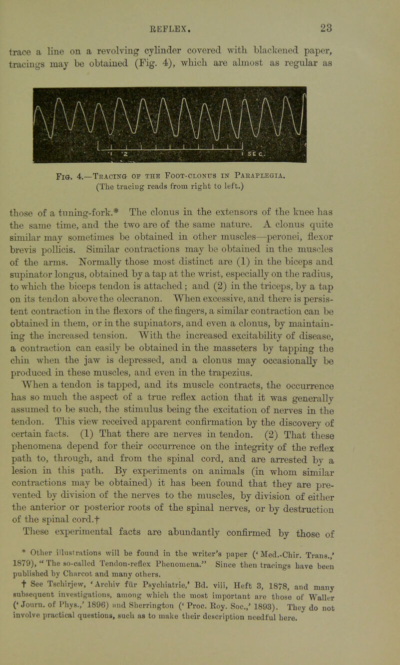 trace a line on a revolving cylinder covered with blackened paper, tracings may be obtained (Fig. 4), which are almost as regular as Fig. 4.—Tracing- op the Foot-clonus in Paraplegia. (The traciug reads from right to left.) those of a tuning-fork.# The clonus in the extensors of the knee has the same time, and the two are of the same nature. A clonus quite similar may sometimes be obtained in other muscles—peronei, flexor brevis pollicis. Similar contractions may be obtained in the muscles of the arms. Normally those most distinct are (1) in the biceps and supinator longus, obtained by a tap at the wrist, especially on the radius, to which the biceps tendon is attached; and (2) in the triceps, by a tap on its tendon above the olecranon. When excessive, and there is persis- tent contraction in the flexors of the fingers, a similar contraction can be obtained in them, or in the supinators, and even a clonus, by maintain- ing the increased tension. With the increased excitability of disease, a contraction can easily be obtained in the masseters by tapping the chin when the jaw is depressed, and a clonus may occasionally be produced in these muscles, and even in the trapezius. When a tendon is tapped, and its muscle contracts, the occurrence has so much the aspect of a true reflex action that it was generally assumed to be such, the stimulus being the excitation of nerves in the tendon. This view received apparent confirmation by the discovery of certain facts. (1) That there are nerves in tendon. (2) That these phenomena depend for their occurrence on the integrity of the reflex path to, through, and from the spinal cord, and are arrested by a lesion in this path. By experiments on animals (in whom similar contractions may be obtained) it has been found that they are pre- vented by division of the nerves to the muscles, by division of either the anterior or posterior roots of the spinal nerves, or by destruction of the spinal cord.f These experimental facts are abundantly confirmed by those of * Other illustrations will be found in the writer’s paper (‘Med.-Chir. Trans.,’ 1879), “ The so-called Tendon-reflex Phenomena.” Since then tracings have been published by Charcot and many others. f See Tschirjew, ‘Archiv fur Psychiatric,’ Bd. viii, Heft 3, 1878, and many subsequent investigations, among which the most important are those of Waller (‘Journ. of Phys.,’ 1896) and Sherrington (‘ Proc. Roy. Soc.,’ 1893). They do not involve practical questions, such as to make their description needful here.