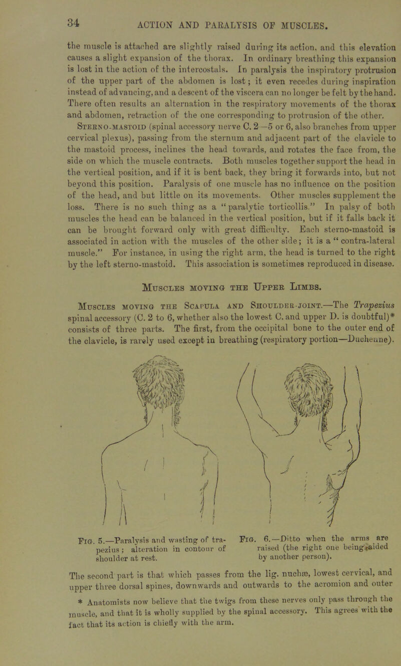 the muscle is attached are slightly raised during its action, and this elevation causes a slight expansion of the thorax. In ordinary breathing this expansion is lost in the action of the intercostals. In paralysis the inspiratory protrusion of the upper part of the abdomen is lost; it even recedes during inspiration instead of advancing,and a descent of the viscera can no longer be felt by the hand. There often results an alternation in the respiratory movements of the thorax and abdomen, retraction of the one corresponding to protrusion of the other. Sterno-mastoid (spinal accessory nerve C. 2—5 or 6, also branches from upper cervical plexus), passing from the sternum and adjacent part of the clavicle to the mastoid process, inclines the head towards, and rotates the face from, the side on which the muscle contracts. Both muscles together support the head in the vertical position, and if it is bent back, they bring it forwards into, but not beyond this position. Paralysis of one muscle has no influence on the position of the head, and but little on its movements. Other muscles supplement the loss. There is no such thing as a “ paralytic torticollis.” In palsy of both muscles the head can be balanced in tbe vertical position, but if it falls back it can be brought forward only with great difficulty. Each sterno-mastoid is associated in action with the muscles of the other side; it is a “ contra-lateral muscle.” For instance, in using the right arm, the head is turned to the right by the left sterno-mastoid. This association is sometimes reproduced in disease. Muscles moving the Upper Limbs. Muscles moving the Scapula and Shoulder-joint.—The Trapezius spinal accessory (C. 2 to 6, whether also the lowest C. and upper D. is doubtful)* consists of three parts. The first, from the occipital bone to the outer end of the clavicle, is rarely used except in breathing (respiratory portion—Ducheune). Fig. 5.—Paralysis and wasting of tra- Fig. 6.—Ditto when the arms are pezius ; alteration in contour of raised (the right one beiugtaided shoulder at rest. by another person). The second part is that which passes from the lig. nuchse, lowest cervical, and upper three dorsal spines, downwards and outwards to the acromion and outer * Anatomists now believe that the twigs from these nerves only pass through the muscle, and that it is wholly supplied by the spinal accessory. This agrees with the tact that its action is chiefly with the arm.