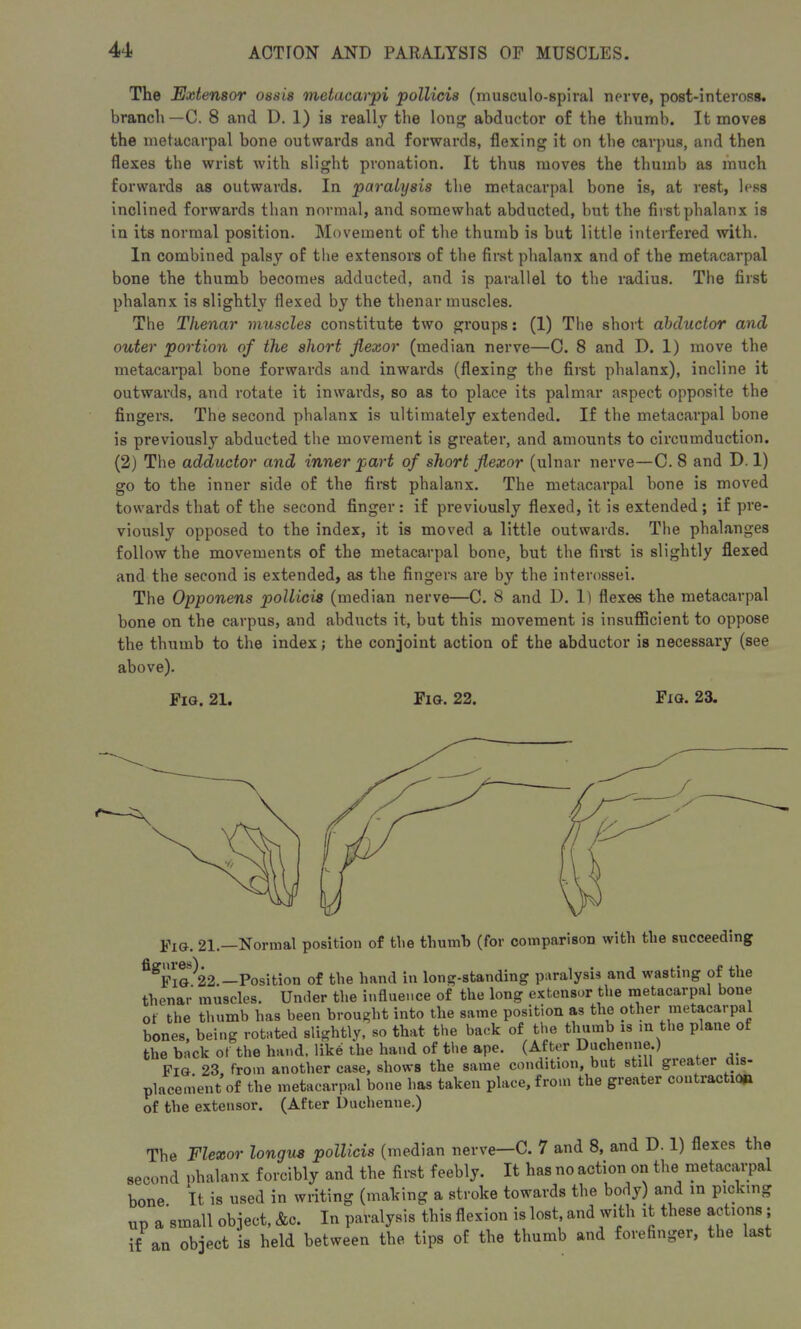 The Extensor ossis metacarpi pollicis (musculo-spiral nerve, post-inteross. branch—C. 8 and D. 1) is really the long abductor of the thumb. It moves the metacarpal bone outwards and forwards, flexing it on tbe carpus, and then flexes the wrist with slight pronation. It thus moves the thumb as much forwards as outwards. In paralysis the metacarpal bone is, at rest, less inclined forwards than normal, and somewhat abducted, but the first phalanx is in its normal position. Movement of tbe thumb is but little interfered with. In combined palsy of the extensors of tbe first phalanx and of the metacarpal bone the thumb becomes adducted, and is parallel to tbe radius. The first phalanx is slightly flexed by the thenar muscles. The Thenar muscles constitute two groups: (1) The short abductor and outer portion of the short flexor (median nerve—C. 8 and D. 1) move the metacarpal bone forwards and inwards (flexing the first phalanx), incline it outwards, and rotate it inwards, so as to place its palmar aspect opposite the fingers. The second phalanx is ultimately extended. If the metacarpal bone is previously abducted the movement is greater, and amounts to circumduction. (2) The adductor and inner part of short flexor (ulnar nerve—C. 8 and D. 1) go to the inner side of the first phalanx. The metacarpal bone is moved towards that of the second finger: if previously flexed, it is extended; if pre- viously opposed to the index, it is moved a little outwards. The phalanges follow the movements of the metacarpal bone, but the first is slightly flexed and the second is extended, as the fingers are by the interossei. The Opponens pollicis (median nerve—C. 8 and D. 1) flexes the metacarpal bone on the carpus, and abducts it, but this movement is insufficient to oppose the thumb to the index; the conjoint action of the abductor is necessary (see above). Fig. 21. Fig. 22. Fig. 23. Fig. 21.—Normal position of the thumb (for comparison with the succeeding ^Fig^22.—Position of the hand in long-standing paralysis and wasting of the thenar muscles. Under the influence of the long extensor the metacarpal bone of the thumb has been brought into the same position as the other metacarpal bones, being rotated slightly, so that the back of the thumb is m the plane of the back of the hand, like the hand of the ape. (After Duclienne.) Fig. 23, from another case, shows the same condition, but still gieatei dis- placement of the metacarpal bone has taken place, from the greater contraction of the extensor. (After Duehenne.) The Flexor longus pollicis (median nerve—C. 7 and 8, and D. 1) flexes the second phalanx forcibly and the first feebly. It has no action on the metacarpal bone. It is used in writing (making a stroke towards the body) and in picking up a small object, &c. In paralysis this flexion is lost, and with it these actions ; if an object is held between the tips of the thumb and forefinger, the last