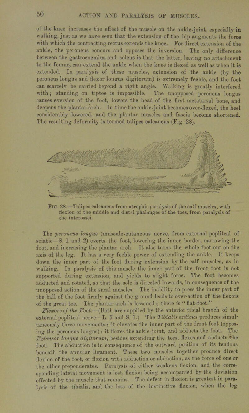 of the knee increases the effect of the muscle on the ankle-joint, especially in walking, just as we have seen that the extension of the hip augments the force with which the contracting rectus extends the knee. For direct extension of the ankle, the peroneus concurs and opposes the inversion. The only difference between the gastrocnemius and soleus is that the latter, having no attachment to the femur, can extend the ankle when the knee is flexed as well as when it is extended. In paralysis of these muscles, extension of the ankle (by the peroneus Iongus and flexor longus digitorum) is extremely feeble, and the foot can scarcely be carried beyond a right angle. Walking is greatly interfered with; standing on tiptoe is impossible. The unopposed peroneus longus causes eversion of the foot, lowers the head of the first metatarsal bone, and deepens the plantar arch. In time the ankle-joint becomes over-flexed, the heel considerably lowered, and the plantar muscles and fascia become shortened. The resulting deformity is termed talipes calcaneus (Fig. 28). Fig. 28—Talipes calcaneus from atrophic, paralysis of the calf muscles, with flexion of the middle and distal phalanges of the toes, from paralysis of che interossei. The peroneus longus (musculo-cutaneous nerve, from external popliteal of sciatic—S. 1 and 2) everts the foot, lowering the inner border, narrowing the foot, and increasing the plantar arch. It also turns the whole foot out on the axis of the leg. It has a very feeble power of extending the ankle. It keeps down the inner part of the foot during extension by the calf muscles, as in walking. In paralysis of this muscle the inner part of the front foot is not supported during extension, and yields to slight force. The foot becomes adducted and rotated, so that the sole is directed inwards, in consequence of the unopposed action of the sural muscles. The inability to press the inner part of the ball of the foot firmly against the ground leads to over-action of the flexors of the great toe. The plantar arch is lessened ; there is “ fiat-foot.” Flexors of the Foot.—(Both are supplied by the anterior tibial branch of the external popliteal nerve—L. 5 and S. 1.) The Tibialis anticus produces simul- taneously three movements: it elevates the inner part of the front foot (oppos- ing the peroneus longus) ; it flexes the ankle-joint, and adducts the foot. The Extensor longus digitorum, besides extending the toes, flexes and abducts *the foot. The abduction is in consequence of the outward position of its tendons beneath the annular ligament. These two muscles together produce direct flexion of the foot, or flexion with adduction or abduction, as the force of one or the other pi’eponderates. Paralysis of either weakens flexion, and the corre- sponding lateral movement is lost, flexion being accompanied by the deviation effected by the muscle that remains. The defect in flexion is greatest in para- lysis of the tibialis, and the loss of the instinctive flexion, when the leg