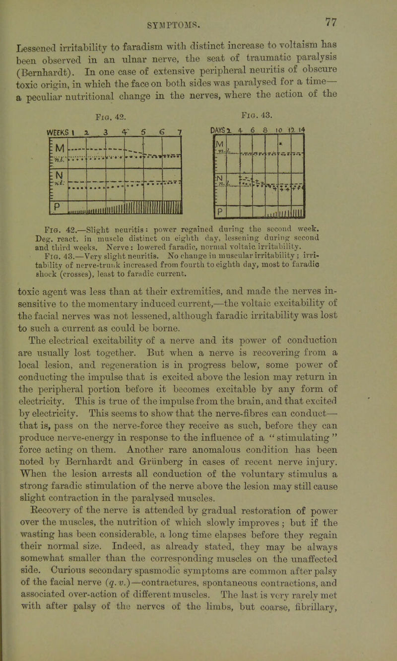 Lessened irritability to faradism with distinct increase to voltaism has been observed in an ulnar nerve, the seat of traumatic paialysis (Bernhardt). In one case of extensive peripheral neuritis of obscure toxic origin, in which the face on both sides was paralysed ioi a time a peculiar nutritional change in the nerves, where the action of the Fig. 42. WEfKS I x 3 y S 6 7 [M In.l.' 1 • • • ViVi m « [N • • • • • • •  71 •••* • p ■'Hill iiHllll Mini 11 Fig. 43. Fig. 42.—Slight neuritis: power regained during the second week. Deg. react, in muscle distinct on eighth day, lessening during second and third weeks. Nerve: lowered faradic, normal voltaic.irritability. Fig. 43.—Very slight neuritis. No change in muscular irritability; irri- tability of nerve-trunk increased from fourth to eighth day, most to faradic shock (crosses), least to faradic current. toxic agent was less than at their extremities, and made the nerves in- sensitive to the momentary induced current,—the voltaic excitability of the facial nerves was not lessened, although faradic irritability was lost to such a current as could be borne. The electrical excitability of a nerve and its power of conduction are usually lost together. But when a nerve is recovering from a local lesion, and regeneration is in progress below, some power of conducting the impulse that is excited above the lesion may return in the peripheral portion before it becomes excitable by any form of electricity. This is true of the impulse from the brain, and that excited by electricity. This seems to show that the nerve-fibres can conduct— that is, pass on the nerve-force they receive as such, before they can produce nerve-energy in response to the influence of a “ stimulating ” force acting on them. Another rare anomalous condition has been noted by Bernhardt and Griinberg in cases of recent nerve injury. When the lesion arrests all conduction of the voluntary stimulus a strong faradic stimulation of the nerve above the lesion may still cause slight contraction in the paralysed muscles. Recovery of the nerve is attended by gradual restoration of power over the muscles, the nutrition of which slowly improves ; but if the wasting has been considerable, a long time elapses before they regain their normal size. Indeed, as already stated, they may be always somewhat smaller than the corresponding muscles on the unaffected side. Curious secondary spasmodic symptoms are common after palsy of the facial nerve (q.v.)—contractures, spontaneous contractions, and associated over-action of different muscles. The last is very rarely met with after palsy of the nerves of the limbs, but coarse, fibrillary.