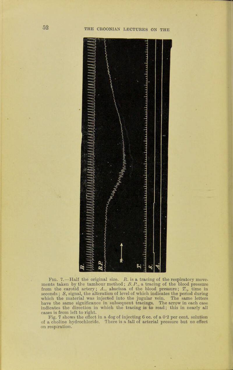 Fig. 7.-—Half the original size. B. is a tracing of the respiratory move- ments taken by the tambour method; B. P., a tracing of the blood pressure from the carotid artery; A., abscissa of the blood pressure; T., time in seconds ; S, signal, the alteration of level of which indicates the period during which the material was injected into the jugular vein. The same letters have the same significance in subsequent tracings. The arrow in each case indicates the direction in which the tracing is to read; this in nearly all cases is from left to right. Pig. 7 shows the effect in a dog of injecting 6 cc. of a 0-2 per cent, solution of a choline hydrochloride. There is a fall of arterial pressure but no effect on respiration.