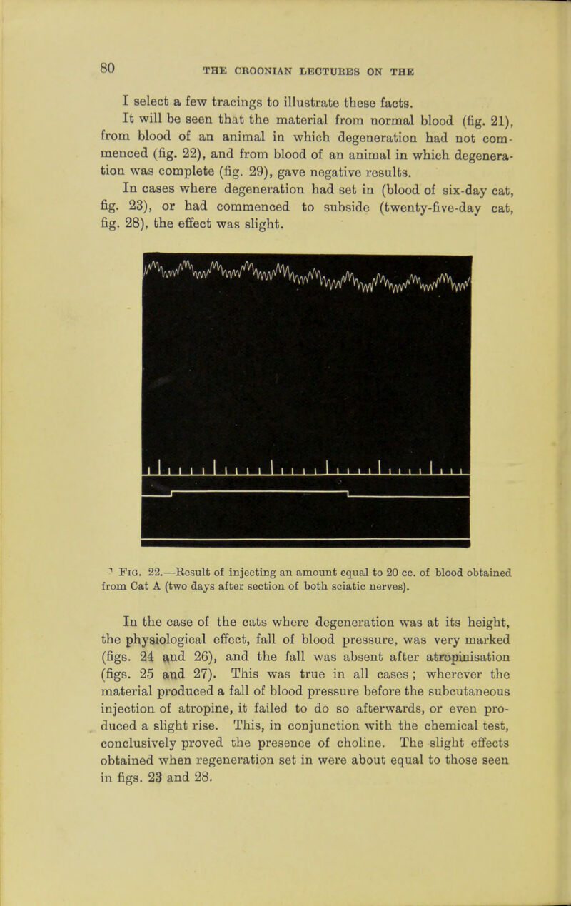 I select a few tracings to illustrate these facts. It will be seen that the material from normal blood (fig. 21), from blood of an animal in which degeneration had not com- menced (fig. 22), and from blood of an animal in which degenera- tion was complete (fig. 29), gave negative results. In cases where degeneration had set in (blood of six-day cat, fig. 23), or had commenced to subside (twenty-five-day cat, fig. 28), the effect was slight. 1 Fig. 22.—Result of injecting an amount equal to 20 cc. of blood obtained from Cat A (two days after section of both sciatic nerves). In the case of the cats where degeneration was at its height, the physiological effect, fall of blood pressure, was very marked (figs. 24 and 26), and the fall was absent after atropinisation (figs. 25 and 27). This was true in all cases ; wherever the material produced a fall of blood pressure before the subcutaneous injection of atropine, it failed to do so afterwards, or even pro- duced a slight rise. This, in conjunction with the chemical test, conclusively proved the presence of choline. The slight effects obtained when regeneration set in were about equal to those seen in figs. 23 and 28.