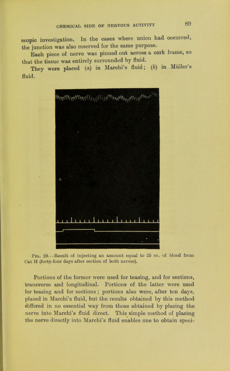 scopic investigation. In the cases where union had occurred, the junction was also reserved for the same purpose. Bach piece of nerve was pinned out across a cork frame, so that the tissue was entirely surrounded by fluid. They were placed (a) in Marchi's fluid; (b) in Muller's fluid. Fig. 29.—Result of injecting an amount equal to 25 cc. of blood from Cat H (forty-four days after section of both nerves). Portions of the former were used for teasing, and for sections, transverse and longitudinal. Portions of the latter were used for teasing and for sections ; portions also were, after ten days, placed in Marchi's fluid, but the results obtained by this method differed in no essential way from those obtained by placing the nerve into Marchi's fluid direct. This simple method of placing the nerve directly into Marchi's fluid enables one to obtain speci-