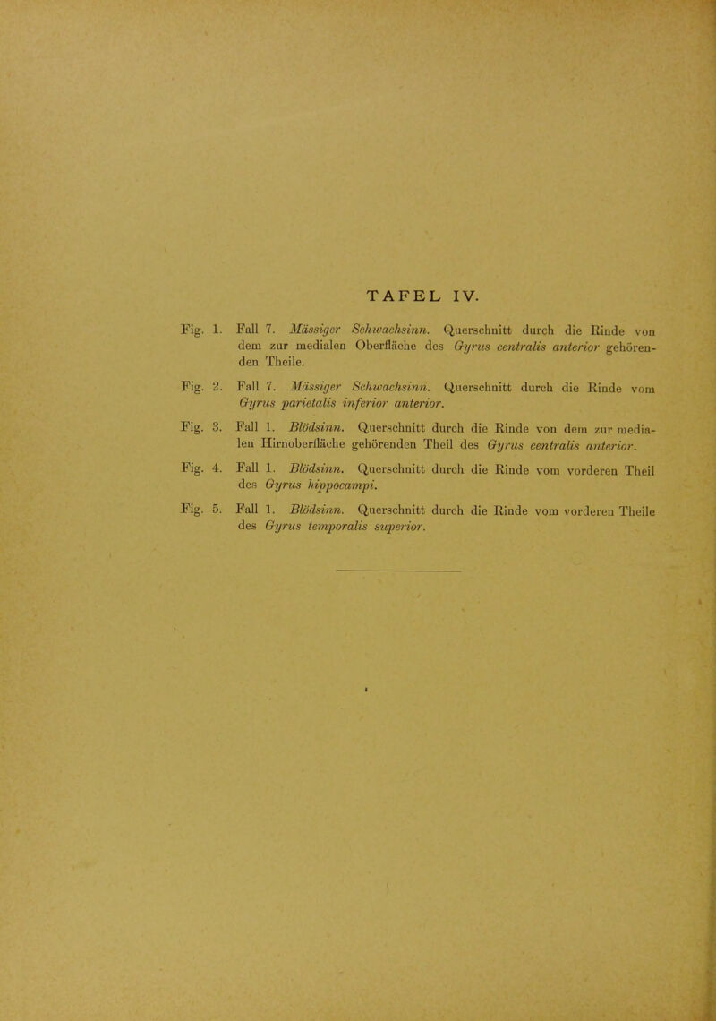 Fig. 1. Fall 7. Mdssigcr Schwachsinn. Querschnitt durch die Rinde von dem zur medialen Oberflache des Gyrus centralis anterior gehoren- den Theile. Fig. 2. Fall 7. Mdssiger Schwachsinn. Querschnitt durch die Rinde vom Gyrus parietalis inferior anterior. Fig. 3. Fall 1. Blbdsinn. Querschnitt durch die Rinde von dem zur media- len Hirnoberflache gehorenden Theil des Gyrus centralis anterior. Fig. 4. Fall 1. Blbdsinn. Querschnitt durch die Rinde vom vorderen Theil des Gyrus hippocampi. Fig. 5. Fall 1. Blbdsinn. Querschnitt durch die Rinde vom vordereu Theile des Gyrus temporalis superior.