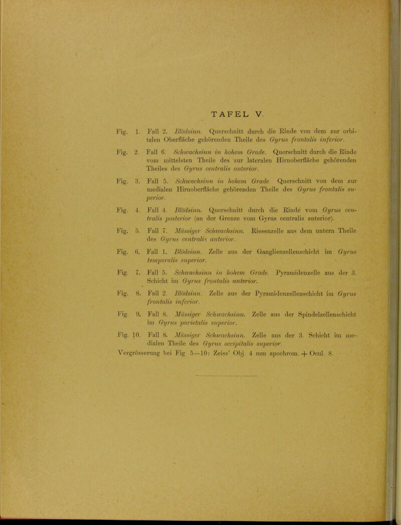 Fig. 1. Fall 2. Blodsinn. Querschnitt durch die Rinde von dem zur orbi- taleu Oberflache gehorenden Theile des Gyrus frontalis inferior. Fig. 2. Fall 6. Schwachsinn in hohem Grade. Querschnitt durch die Rinde vom mittelsten Theile des zur lateralen Hirnoberflache gehorenden Theiles des Gyrus centralis anterior. Fig. 3. Fall 5. Schwachsinn in hohem Grade Querschnitt von dem zur medialen Hirnoberflache gehorenden Theile des Gyrus frontalis su- perior. Fig. 4. Fall 4. Blodsinn. Querschnitt durch die Rinde vom Gyrus cen- tralis posterior (an der Grenze vom Gyrus centralis anterior). Fig. 5. Fall 7. Mdssiyer Schivachsinn. Riesenzelle aus dem untern Theile des Gyrus centralis anterior. Fig. 6. Fall 1. Blodsinn. Zelle aus der Ganglienzellenschicht im Gyrus temporalis superior. Fig. 7. Fall 5. Schivachsinn in hohem Grade. Pyrarnidenzelle aus der 3. Schicht im Gyrus frontalis anterior. Fig. 8. Fall 2. Blodsinn. Zelle aus der Pyramidenzellenschicht im Gyrus frontalis inferior. Fig. 9. Fall S. Massiger Schivachsinn. Zelle aus der Spindelzellenschicht im Gyrus parietalis superior. Fig. 10. Fall 8. Mdssiyer Schwachsinn. Zelle aus der 3. Schicht im me- dialen Theile des Gyrus occipitalis superior. Vergrosserung bei Fig 5—10: Zeiss' Obj. 4 mm apochrom. + Ocul. 8.