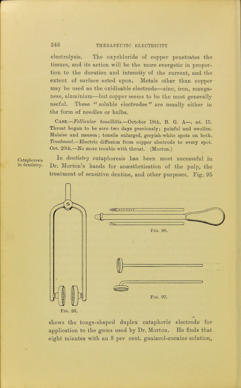 electrolysis. The oxychloride of copper penetrates the tissues, and its action will be the more energetic in propor- tion to the duration and intensity of the current, and the extent of surface acted upon. Metals other than copper may be used as the oxidisable electrode—zinc, iron, manga- nese, aluminium—but copper seems to be the most generally useful. These soluble electrodes are usually either in the form of needles or bulbs. Case.—Follicular tonsillitis.—October 18th, B. G. A—, set. 15. Throat began to be sore two days previously; painful and swollen. Malaise and nausea; tonsils enlarged, greyish-white spots on both. Treatment.—Electric diffusion from copper electrode to every spot. Oct. 20th.—No more trouble with throat. (Morton.) Cataphoresis dentistry cataphoresis has been most successful in in dentistry. Di-. Morton's hands for an^stlietisation of the pulp, the treatment of sensitive dentine, and other purposes. Fig. 95 Fi&. 95. shows the tongs-shaped duplex cataphoric electrode for application to the gums used by Dr. Morton. He finds that eight minutes with an 8 per cent, guaiacol-cocaine solution.