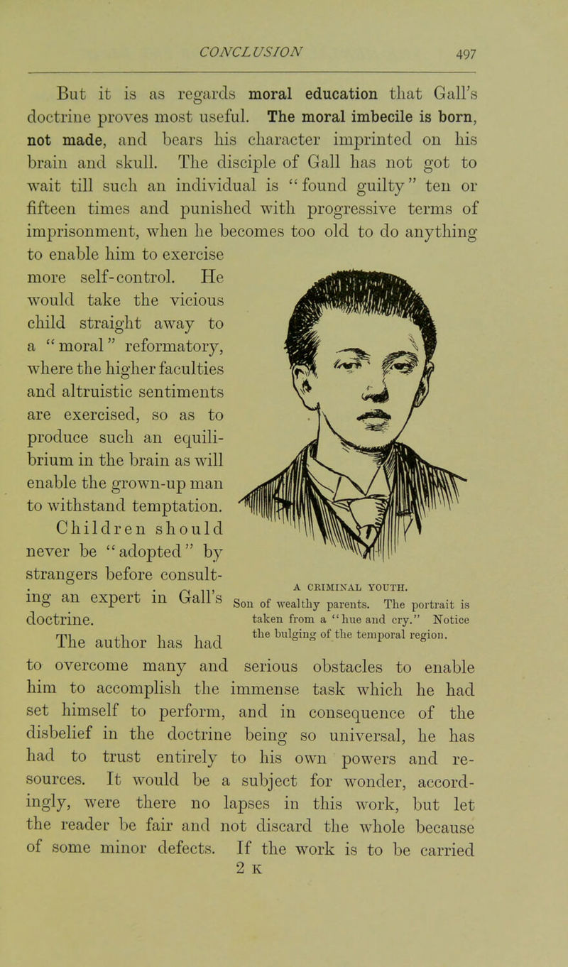 But it is as regards moral education that Gall's doctrine proves most useful. The moral imbecile is born, not made, and bears his character imprinted on his brain and skull. The disciple of Gall has not got to wait till such an individual is found guilty ten or fifteen times and punished with progressive terms of imprisonment, when he becomes too old to do anything to enable him to exercise more self-control. He would take the vicious child straight away to a  moral  reformatory, where the higher faculties and altruistic sentiments are exercised, so as to produce such an equili- brium in the brain as will enable the grown-up man to withstand temptation. Children should never be adopted by strangers before consult- ^ A CRIMINAL YOUTH. ing an expert in Galls Son of wealthy parents. The portrait is doctrine. taken from a hue and cry. Notice The author has had <>f the temporal region, to overcome many and serious obstacles to enable him to accomplish the immense task which he had set himself to perform, aud in consequence of the disbelief in the doctrine being so universal, he has had to trust entirely to his own powers and re- sources. It would be a subject for wonder, accord- ingly, were there no lapses in this work, but let the reader be fair and not discard the whole because of some minor defects. If the work is to be carried 2 K