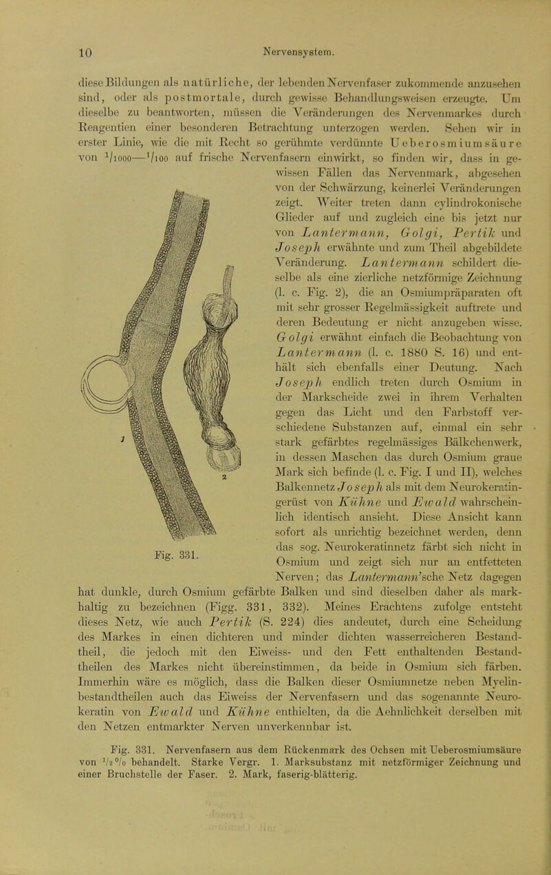 (lieseBildungen als natiirliche, der lebendenNervenfaser zukomniende anzusehen siud, oder als postmortale, durch gewisse Behandhmgsweisen erzeugte. Um dieselbe zu beantworten, iiiiisseii die Veraiidenuigen des Nervenmarkes durch Reagentien einer besondereii Betrachtung unterzogeii werden. Sehen wir in ei'ster Linie, wie die mit Recht so geriihmte verdiinnte Ueberosmiumsaure von ^/looo—'/lOo auf frische Nervenfasern einwirkt, so finden wir, dass in ge- Avissen Fallen das Nervenniark, abgesehen von der Schwarzung, keinerlei Veranderungen zeigt. Weiter treten dann c}dindrokonische Glieder auf und zugleich eine bis jetzt nur von Lantermann, Golgi, PertiJc und Joseph erwahnte und zum Theil abgebildete Veranderung. Lantermann schildert die- selbe als eine zierliche netzformige Zeichnung (1. c. Fig. 2), die an Osmiumpraparaten oft mit sehr grosser Regelniassigkeit auftrete und deren Bedeutung er nicbt anzugeben wisse. Golgi erwahnt einfach die Beobacbtung von Lantermann (1. c. 1880 S. 16) und ent- halt sich ebenfalls einer Deutung. Nach tfosejjh endlich ti'eten durch Osmium in der Markscheide zwei in ihrem Verhalten gegen das Licht vmd den Farbstoff ver- schiedene Substanzen auf, einmal ein sehr stark gefarbtes regehnassiges Balkchenwerk, in dessen Maschen das durch Osmium graue Mark sich befinde (1. c. Fig. I und II), welches Balkeunetz Joseph als mit dem Neurokeratin- geriist \on Kiihne imd Eivaid yvahrschein- lich identisch ansieht. Diese Ansicht kann sofoil als unrichtig bezeichnet werden, denn das sog. Neurokeratijinetz fiirbt sich nicht m Osmium und zeigt sich nur an entfetteten Nei-ven; das Lantermann'sche Netz dagegen hat dunkle, dm'ch Osmium gefarbte Balken und sind dieselben daher als mark- haltig zu bezeichnen (Figg. 331, 332). Meures Erachtens zufolge entsteht dieses Netz, wie auch PertiJi (S. 224) dies andeutet, durch eine Scheidimg des Mai'kes in einen dichteren imd minder dichten wasserreichereu Bestand- theil, die jedoch mit den Eiweiss- und den Fett enthaltenden Bestand- theilen des Markes nicht iibereinstimmen, da beide m Osmium sich farben. Immerhin ware es moglich, dass die Balken dieser Osmiumnetze neben Myelin- bestandtheilen auch das Eiweiss der Nervenfasern mid das sogenannte Neuro- keratin von Etc aid imd Kiihne enthielten, da die Aehnlichkeit derselben mit den Netzen entmarkter Nerven unverkennbar ist. Fig. 331. Nervenfasern aus dem Ruckenmark des Ochsen mit UeberosmiumsSure von V2°/o beliandelt. Starke Vergr. 1. Marksubstanz mit netzformiger Zeichnung und einer Bruchstelle der Faser. 2. Mark, faserig-bliitterig.