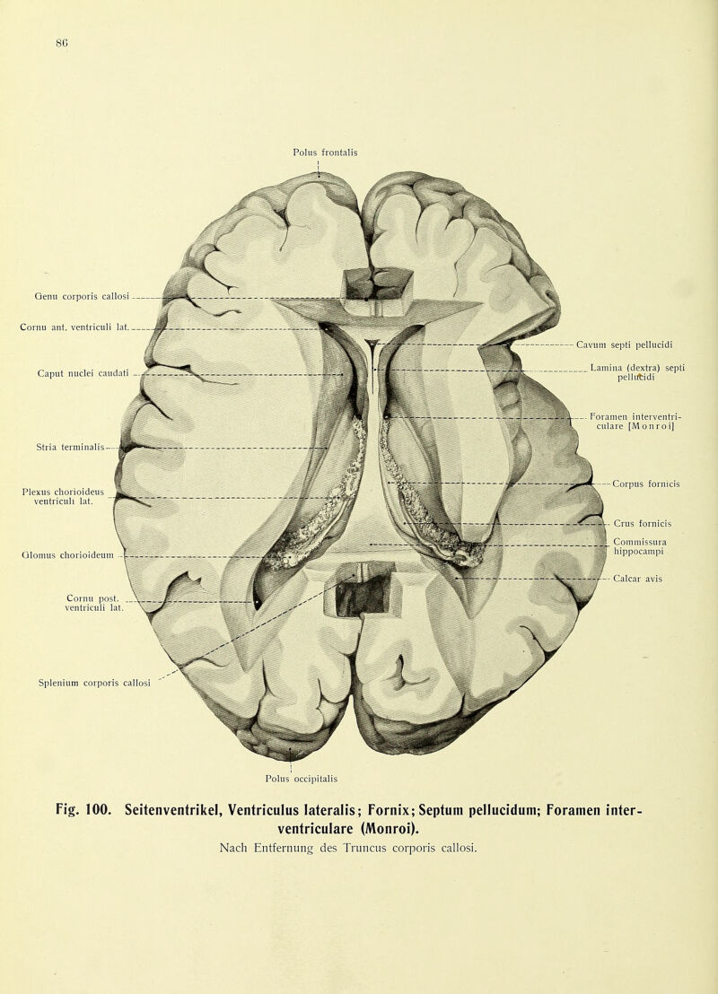 Polus occipitalis Fig. 100. Seitenventrikel, Ventriculus lateralis; Fornix; Septum pellucidum; Foramen inter- ventriculare (Monroi). Nach Entfernung des Truncus corporis callosi.