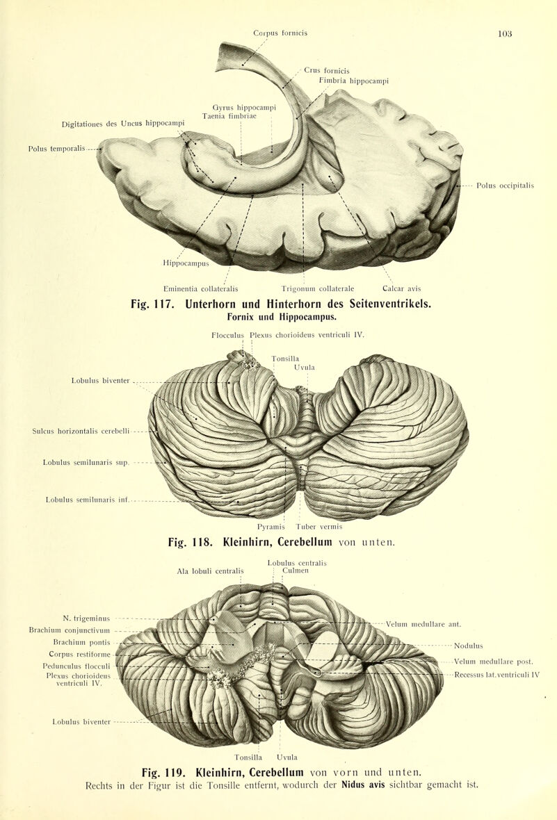 Crus fornicis Fimbria hippocampi Digitationes des Uncus hippocampi Polus temporalis —--jf.-; Gyrus hippocampi Taenia fimbriae Polus occipitalis Hippocampus Eminentia collateralis Trigonum collaterale Calcar avis Fig. 117. Unterhorn und Hinterhorn des Seitenventrikels. Fornix unci Hippocampus. Flocculus Plexus chorioideus ventriculi IV. Tonsilla ! Uvula I ..I.iil.i . enter LUIJ.L.1.1.-M A \V 0\ f\ ' J J J I 1 1 l> Sulcus horizontalis cerebclli - -^^^ '^J^^ J Lobulus semilunaris sup. Lobulus semilunaris inf. >* Pyramis Tuber vermis Fig. 118. Kleinliirn, Cerebellum von unten. Lobulus centralis Ala lobuli centralis Culmen N. trigeminus isrfa ^ . i \ \ v7-' >/| 1—i-.' ^I|mP!2msBI MJWmlk.— Velum medullare ant. Brachium conjunctivum -- ----r-^^\jU._J^Ajp__; f\ Hr.ichin.li ponUs '^yAj^^lf--^ Corpus restiforme ^-y^-^^' -TVi^^c ''N&k n i c, i- waw ' dUSSi^'SJif'1-—--iMS^l ^/S^&^^^r5^^^^ Velum medullare post. Pedunculus flocculi ,\t~~?/~~/~/~/T^Z ^^S^ I ~Jr^^>< ' 9 \ \ V\W%S Plexus chorioideus ///// J^ti^iA^L Ik J/// ~\im'~ | ~ tmtV - -p°—— ventriculi IV Lobulus biventer '-'-'-^ftrVV-W-l Tonsilla Uvula Fig. 119. Kleinhirn, Cerebellum von vorn und unten. Rechts in der Figur ist die Tonsille entfernt, wodurch der Nidus avis sichtbar gemacht ist.