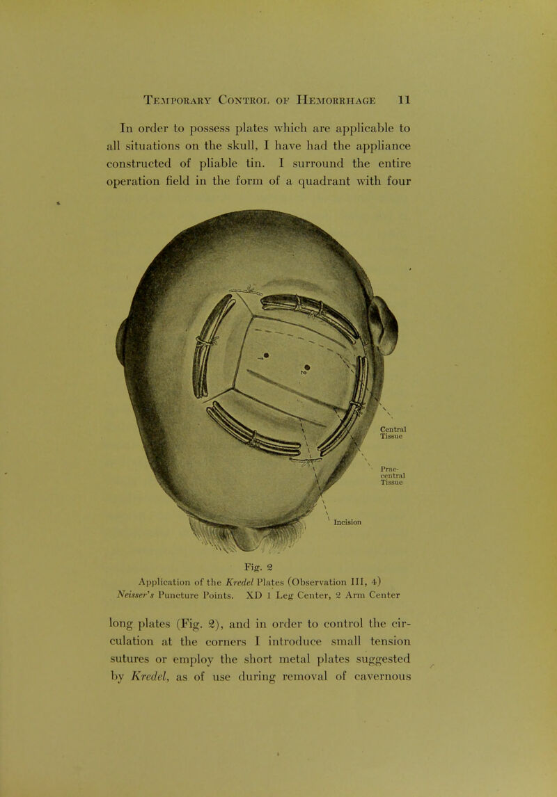 In order to possess plates which are applicable to all situations on the skull, I have had the appliance constructed of pliable tin. I surround the entire operation field in the form of a quadrant with four Fig. 2 Application of the Kredcl Plates (Observation III, 4) Neisser's Puncture Points. XD 1 Leg Center, 2 Ann Center long plates (Fig. 2), and in order to control the cir- culation at the corners I introduce small tension sutures or employ the short metal plates suggested by Kredcl, as of use during removal of cavernous