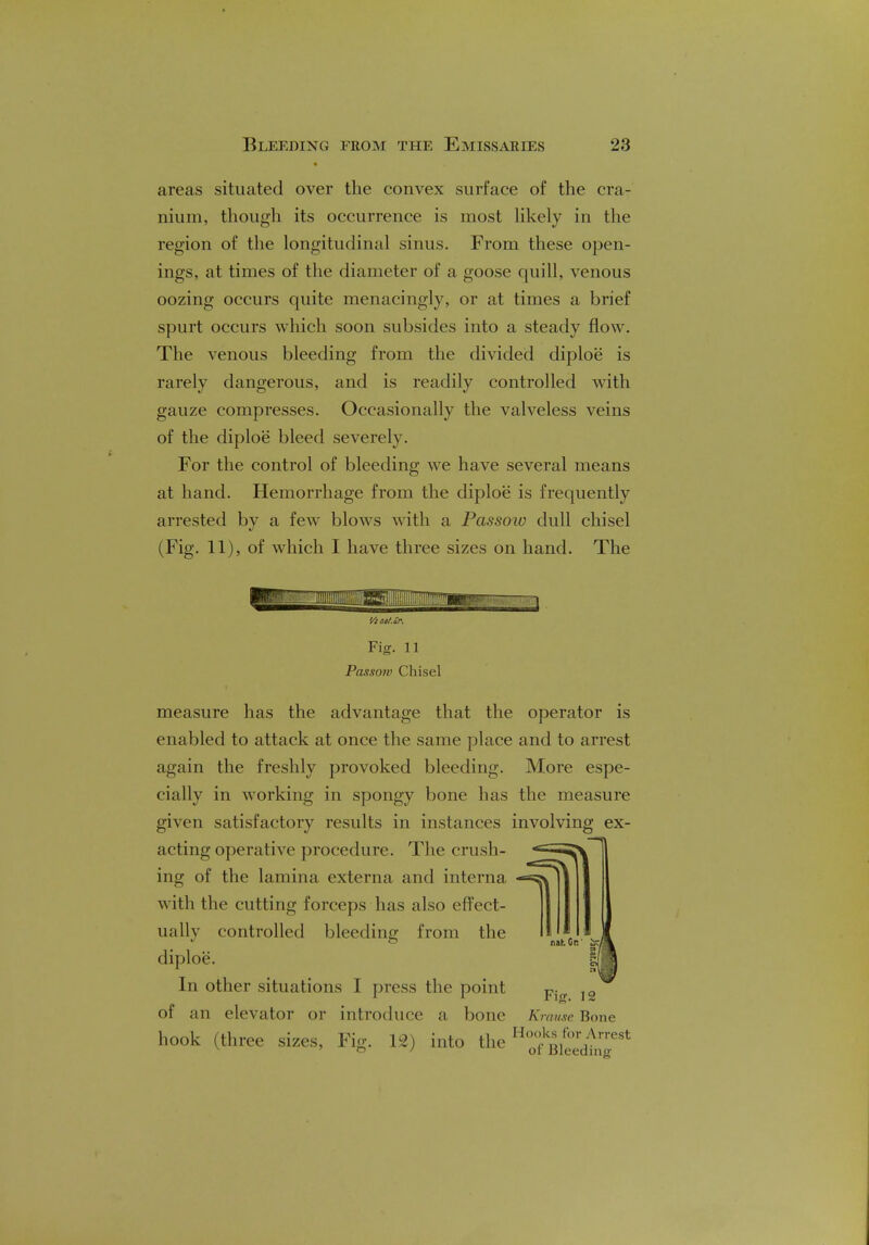 areas situated over the convex surface of the cra- nium, though its occurrence is most likely in the region of the longitudinal sinus. From these open- ings, at times of the diameter of a goose quill, venous oozing occurs quite menacingly, or at times a brief spurt occurs which soon subsides into a steady flow. The venous bleeding from the divided diploe is rarely dangerous, and is readily controlled with gauze compresses. Occasionally the valveless veins of the diploe bleed severely. For the control of bleeding we have several means at hand. Hemorrhage from the diploe is frequently arrested by a few blows with a Passow dull chisel (Fig. 11), of which I have three sizes on hand. The '/im/. Sr. Fig. 11 Passofv Chisel measure has the advantage that the operator is enabled to attack at once the same place and to arrest again the freshly provoked bleeding. More espe- cially in working in spongy bone has the measure given satisfactory results in instances involving ex- acting operative procedure. The crush- ing of the lamina externa and interna with the cutting forceps has also effect- ually controlled bleeding from the diploe. In other situations I press the point of an elevator or introduce a bone Krause Bone hook (three sizes, Fig. 12) into the H5S£^£rt