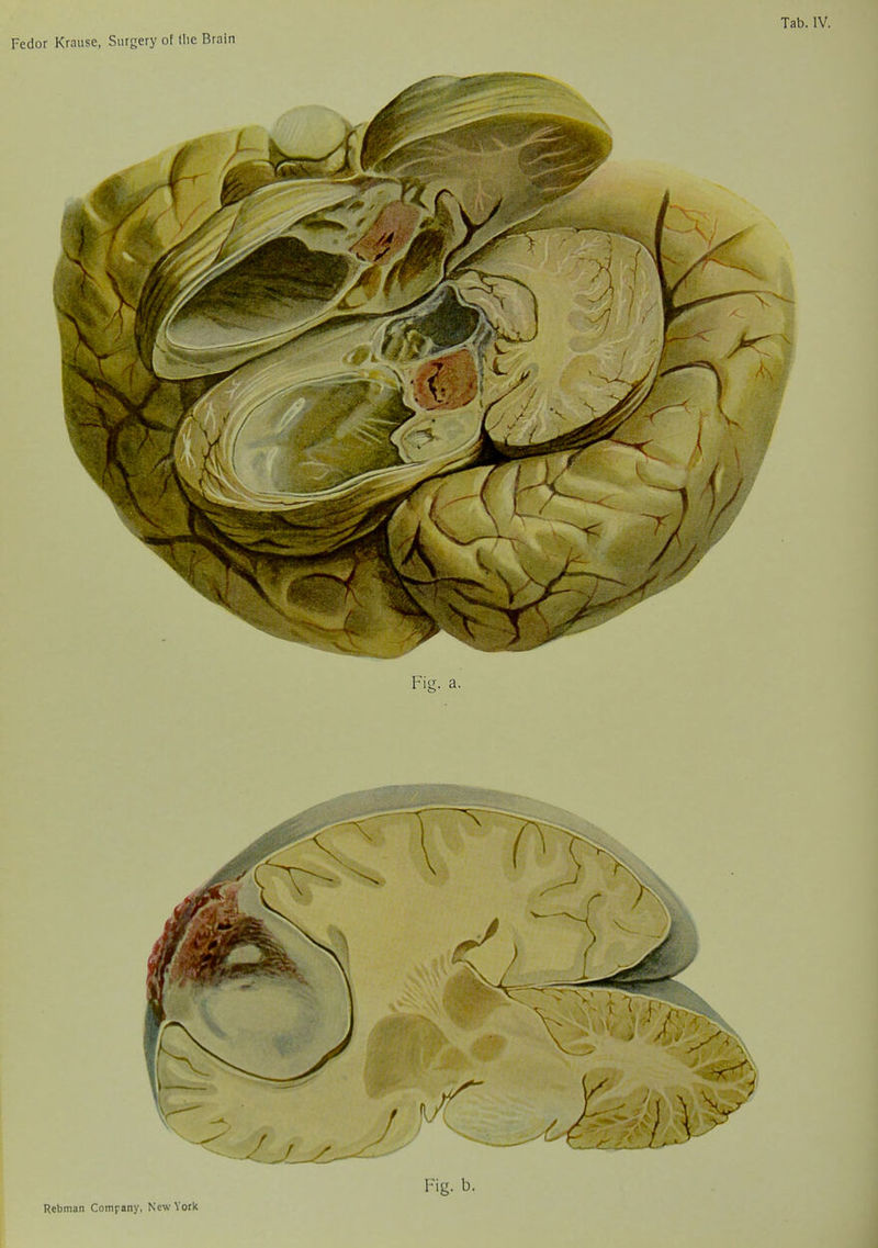 Rebman Company, New York Fig. b.
