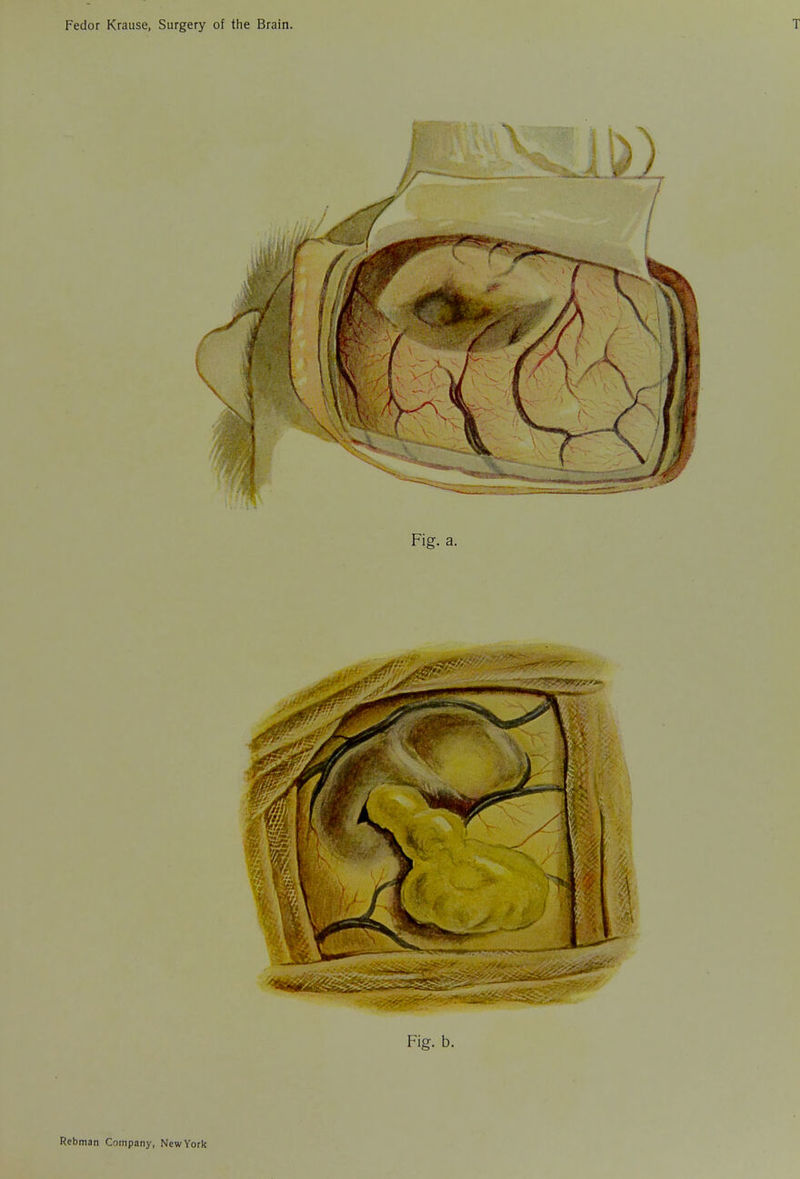 Fig. a. Fig. b.