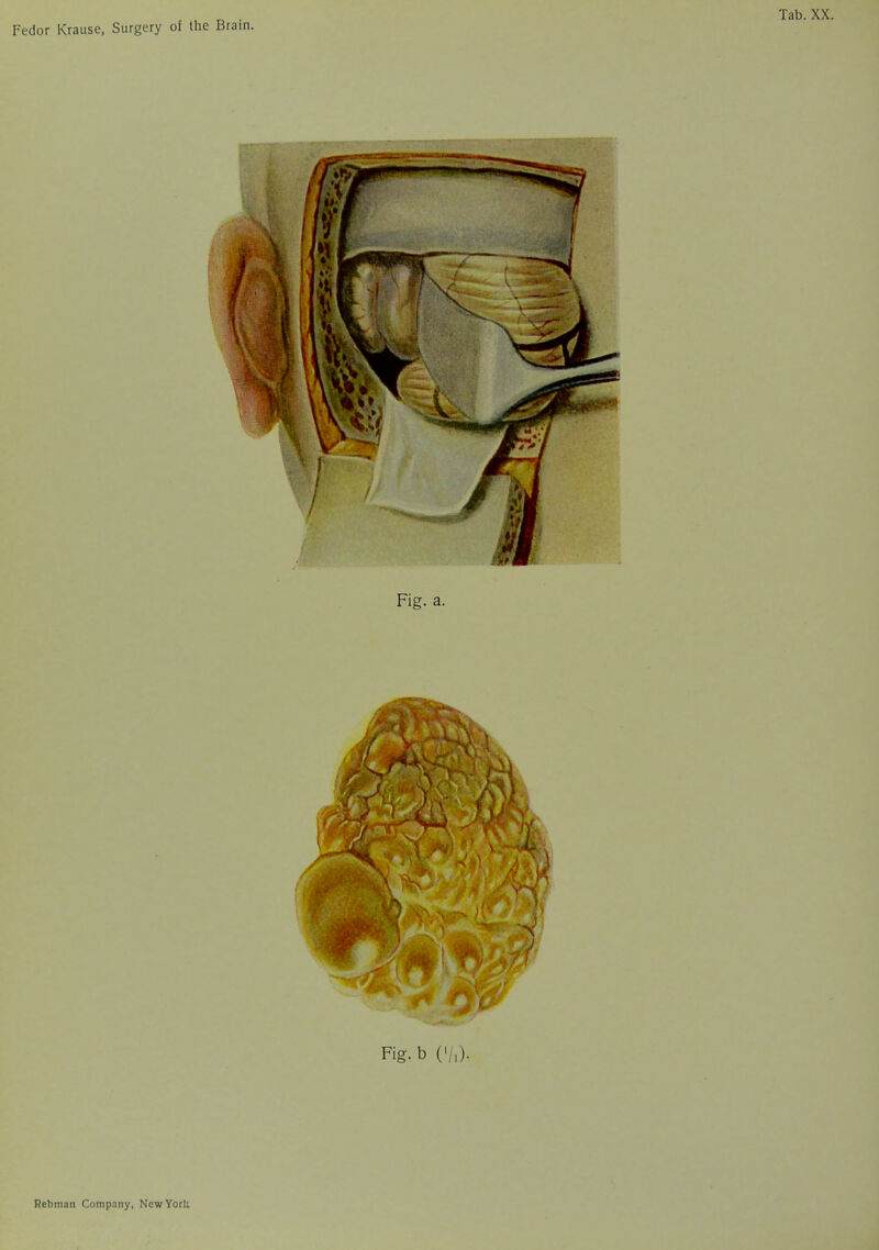 Fig.b ('/,)• Rebman Company, Now York