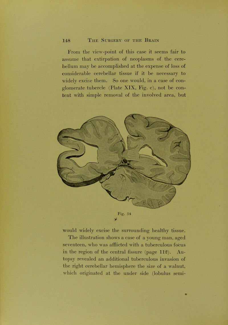 From the view-point of this case it seems fair to assume that extirpation of neoplasms of the cere- bellum may be accomplished at the expense of loss of considerable cerebellar tissue if it be necessary to widely excise them. So one would, in a case of con- glomerate tubercle (Plate XIX, Fig. c), not be con- tent with simple removal of the involved area, but would widely excise the surrounding healthy tissue. The illustration shows a case of a young man, aged seventeen, who was afflicted with a tuberculous focus in the region of the central fissure (page 112). Au- topsy revealed an additional tuberculous invasion of the right cerebellar hemisphere the size of a walnut, which originated at the under side (lobulus semi-