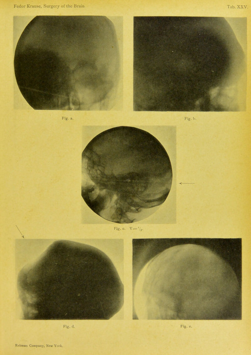 Fig. d. Rebman Company, New York.
