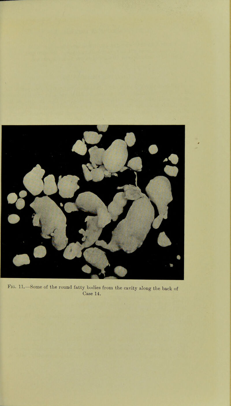 Fig. 11.—Some of the round fatty bodies from the cavity along the back of