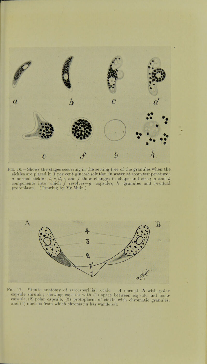 sickles are placed in 1 per cent glucose solution in water at room temperature : a normal sickle ; h, c, d, e, and / show changes in shape and size ; g and h components into which f resolves—= capsules, /i=:granules and residual protoplasm. (Drawing by Mr Muir.) F](i. 17. Minute anatomy of sareos])ori Hal .sickle A noi-tnal, B witli polar capsule .shrunk ; showing cajjsule with (1) space between capsule and i)olar cafisule, (2) polar cap.sule, (3) protoplasm of sickle with chi-omatic granules, and (4) nucleus from wliicli chromatin has wandered.