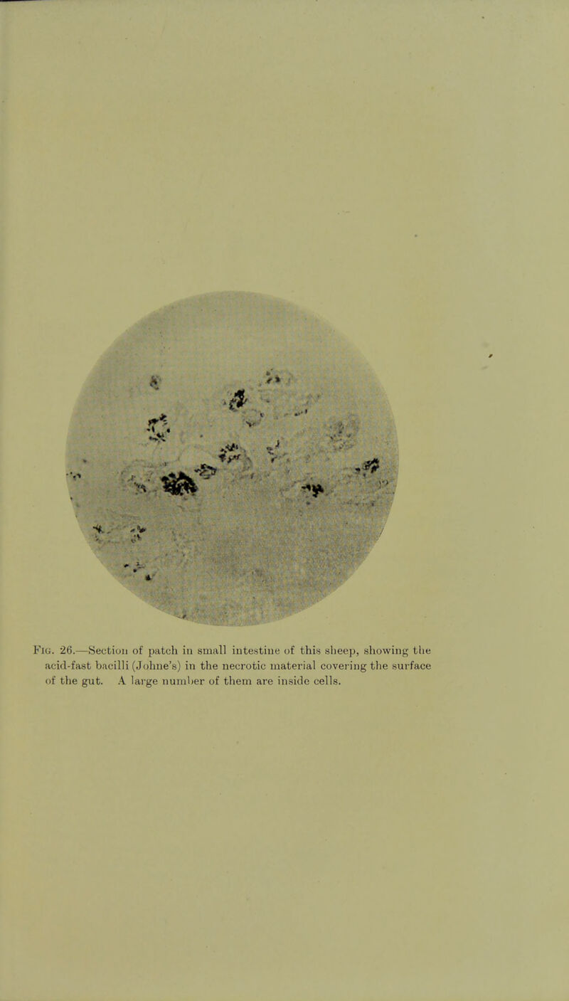 Fig. 26.—Section of patch in small intestine of this sheep, showing the acid-fast bacilli (Johne's) in the necrotic material covering the surface of the gut. \ large number of them are inside cells.