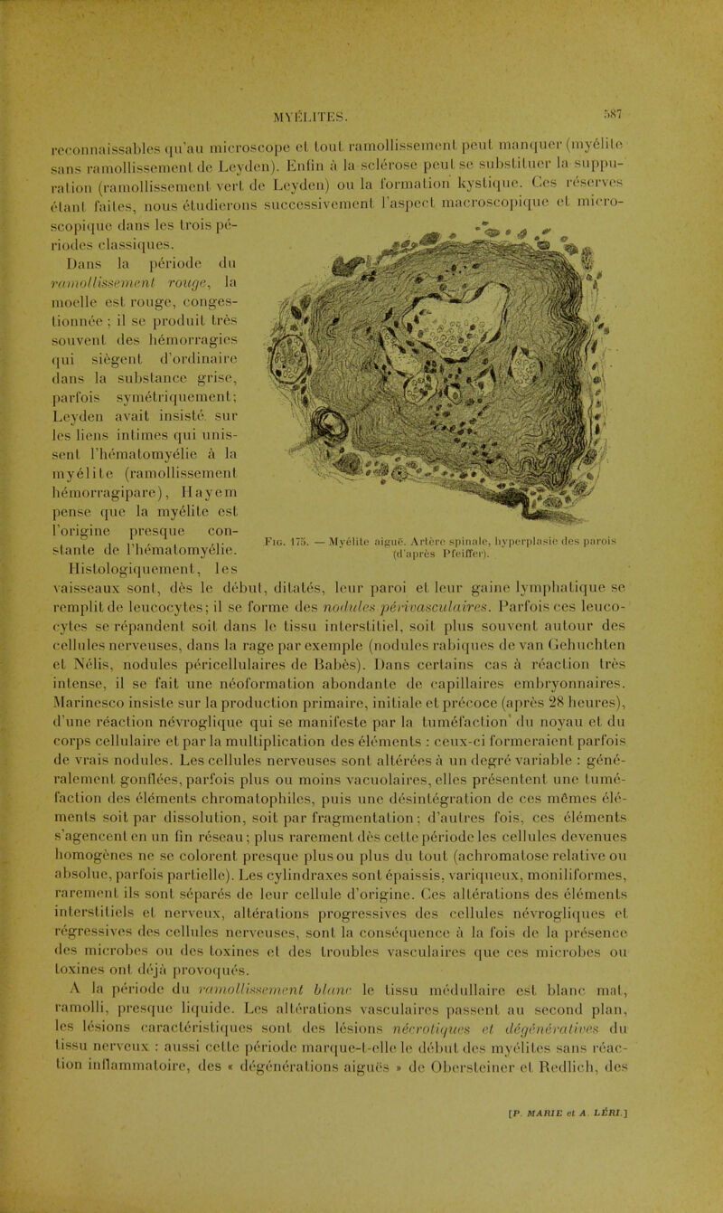 ■)87 reconnaissables quau microscope et louL ramollissemenl pent manquer (mydlilo sans ramollissement de Leyden). Enfin a la sclt^rose peuLse substiliier la suppii- ralion (ramollissemenl vert de Leyden) ou la i'ormaLion kystique. Ges reserves elanl failcs, nous 6tudierons successivemenl laspecL macroscopique ct micro- scopique dans les trois pe- .0^ mm Fig. n Myelilc ai-jue. Arlerc spinale, hyperplasic des parois (d'apres Pfeiffer). riodes classiques. Dans la periode du ramoliissement rouge, la moelle est rouge, conges- tionnee ; il se produit tres sou vent des hemorragies qui si^gent d'ordinaire dans la substance grise, parl'ois sym6triquement; Leyden avail insiste. sur les liens intimes qui unis- sent Thematomyelie a la myelite (ramollissement h^morragipare), Hay em pense que la my61ite est I'origine presque con- stante de riiematomyelie. Histologiquement, les Aaisseaux sont, d6s le debut, dilates, leur parol et leur gaine lymphatique se remplitde leucocytes; il se forme des nodules perivascitlaires. Parfois ces leuco- cytes se repandent soil dans le tissu inlerstitiel, soil plus souvent autour des cellules nerveuses, dans la rage par exemple (nodules rabiques de van Gehuchten el Nelis, nodules pericellulaires de Babes). Dans certains cas a reaction Ires intense, il se fail une neoformalion abondante de capillaires embryonnaires. Marinesco insiste sur la production primaire, iniliale el pr6coce (apr6s 28 heures), d'une reaction n<^vroglique qui se manifesle par la tumefaction' du noyau el du corps cellulaire el par la multiplication des Elements : ceux-ci formeraient parfois de vrais nodules. Les cellules nerveuses sont allereesa un degr6 variable : g^n^- ralement gonflees, parfois plus ou moins vacuolaires, elles pr6senlenl une tume- faction des elements chromatopbilcs, puis une desinlegration de ces m6mes ele- ments soil par dissolution, soil par fragmentation; d'autres fois, ces elements s'agencenten un fin rdseau; plus rarementdes cetlep6riodeles cellules devenues homogdmes ne se colorenl presque plusou plus du tout (achromatose relative ou absolue, parfois partielle). Les cylindraxes sont 6paissis. variqueux, moniliformes, raremenl ils sont s^par^s de leur cellule d'origine. Ges alterations des elements interslitiels et nerveux, alterations progressives des cellules nevrogliques el regressives des cellules nerveuses, sont la consequence a la fois de la presence des microbes ou des toxines et des troubles vasculaires que ces microbes ou loxines out deja provoqu^s. A la periode du ramoUwsement blanr le tissu mcdullaire est blanc mat, ramolli, presque liquide. Les alterations vasculaires passent au second plan, les lesions caracleristiques sont des lesions necrolu/ucs et degeneralives du tissu nerveux : aussi cette p6riode marque-l-elle le debut des myelilcs sans reac- tion inflammatoire, des « degenerations aigues » de Obersleiner et Redlich, des