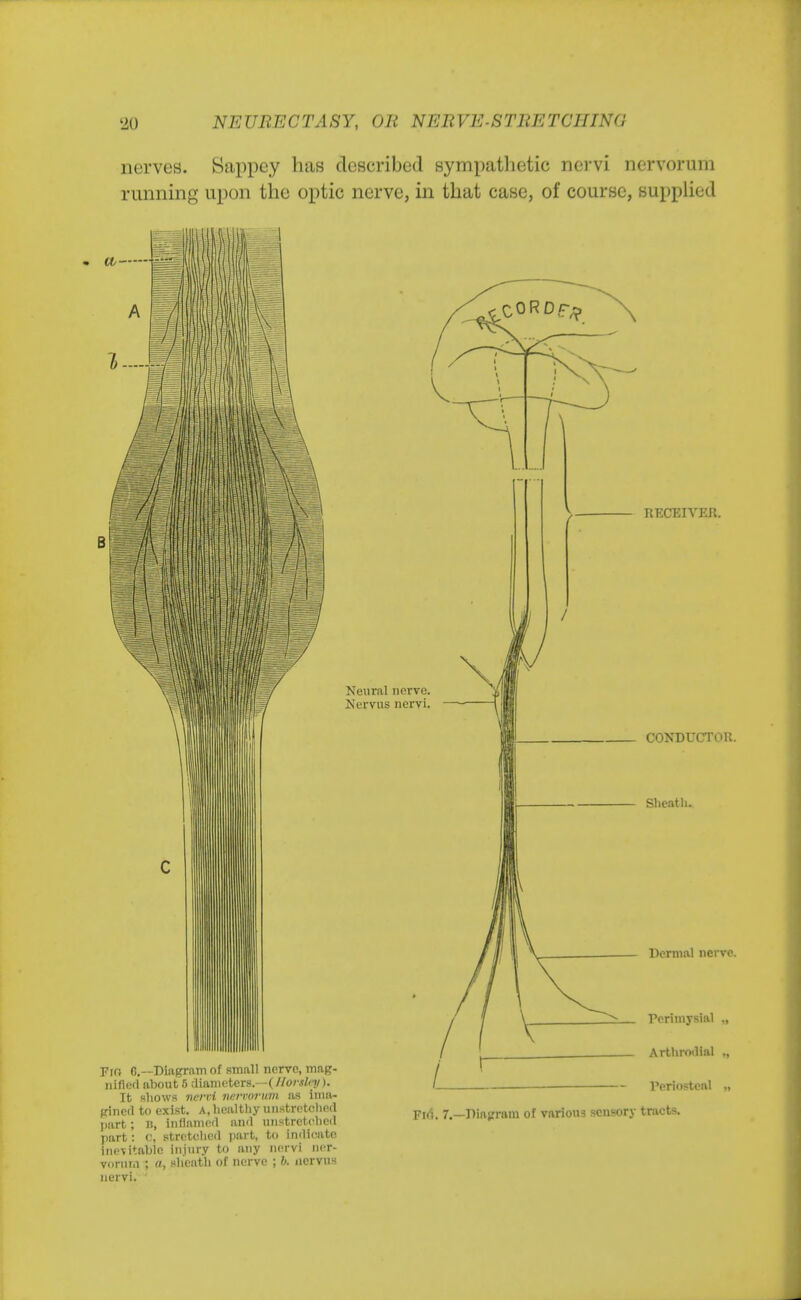 nerves. Sappey has described sympathetic nervi nervorum running upon the optic nerve, in that case, of course, supplied A Neural nerve. Nervus nervi. Fir* G.— Diagram of small nerve, mag- nified about 5 diameters.—( florxlrti). It shows nervi nervorum as ima- gined to exist. A, healthy unstretehed part; B, inflamed and unstretehed part: 0, stretched part, to indicate Inevitable injury to any nervi ner- vorum ; a, sheath of nerve ; b. nervus nervi. RECEIVER. CONDUCTOR. Sheath. Dermal nerve. Perimysial ., Arthrodial ., Periosteal Firi. 7.—Diagram of various .sensory tracts.