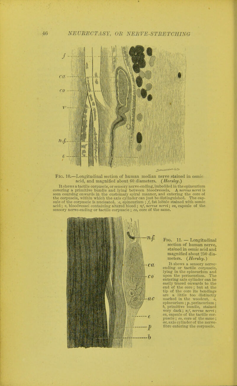 Fig. 10.—Longitudinal section of human median nerve stained in osinic acid, and magnified about CO diameters. (Horsley.) It shows a tactile corpuscle, or sensory nerve-ending, imbedded in the epineurium covering a primitive bundle and 13'ing between bloodvessels. A nervus nervi is seen coursing onwards in the customary spiral manner, and entering the core of the corpuscle, within which the axis cylinder can just be distinguished. The cap- sule of the corpuscle is nucleated, e, epineurium ; /, fat lobule stained with osmic acid ; v, bloodvessel containing altered blood ; nf, nervus nervi; ca, capsule of the sensory nerve-ending or tactile corpuscle ; co, core of the same. Fig. 11. — Longitudinal section of human nerve, stained in osmic acid and magnified about 250 dia- meters. {Horsley.) It shows a sensory nerve- ending or tactile corpuscle, lying in the epineurium and upon the perineurium. The entering axis cylinder can be easily traced onwards to the end of the core ; but at the tip of the core its bondings are a little too distinctly marked in the woodcut, e, epineurium ; p. perineurium ; b, primitive bundle, stained very dark; nf, nervus nervi; ca, capsule of the tactile cor- puscle ; co. core of the same ; ac, axis cylinder of the nerve- fibre entering the corpuscle.