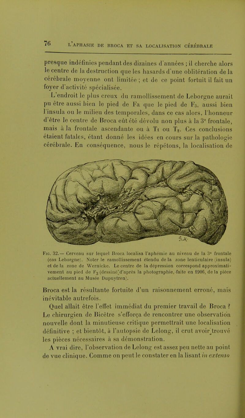 presque indéfinies pendant des dizaines d'années ; ii cherche alors le centre de la destruction que les hasards d'une oblitération de la cérébrale moyenne ont limitée ; et de ce point fortuit il fait un foyer d'activité spécialisée. L'endroit le plus creux du ramollissement de Leborgne aurait pu être aussi bien le pied de Fa que le pied de F3, aussi bien l'insula ou le milieu des temporales, dans ce cas alors, l'honneur d'être le centre de Broca eût été dévolu non plus à la 3e frontale, mais à la frontale ascendante ou à Ti ou T2. Ces conclusions étaient fatales, étant donné les idées en cours sur la pathologie cérébrale. En conséquence, nous le répétons, la localisation de Fig. 32.— Cerveau sur lequel Broca localisa l'aphéinie au niveau de la 3° frontale (cas Leborgne). Noter le ramollissement étendu delà zone lenticulaire insula) et de la zone de Wernicke. Le centre de la dépression correspond approximati- vement au pied de F3 (dessiné'd'après la photographie, faite en 190G, delà pièce actuellement au Musée Dupuytrcn). Broca est la résultante fortuite d'un raisonnement erroné, mais inévitable autrefois. Quel allait être l'effet immédiat du premier travail de Broca ? Le chirurgien do Bicètre s'efforça de rencontrer une observation nouvelle dont la minutieuse critique permettrait une localisation définitive ; et bientôt, à l'autopsie de Lelong, il crut avoir'trouvé les pièces nécessaires à sa démonstration. A vrai dire, l'observation de Lelong est assez peu nette au poinl de vue clinique. Comme on peut le constater en la lisant in extenso