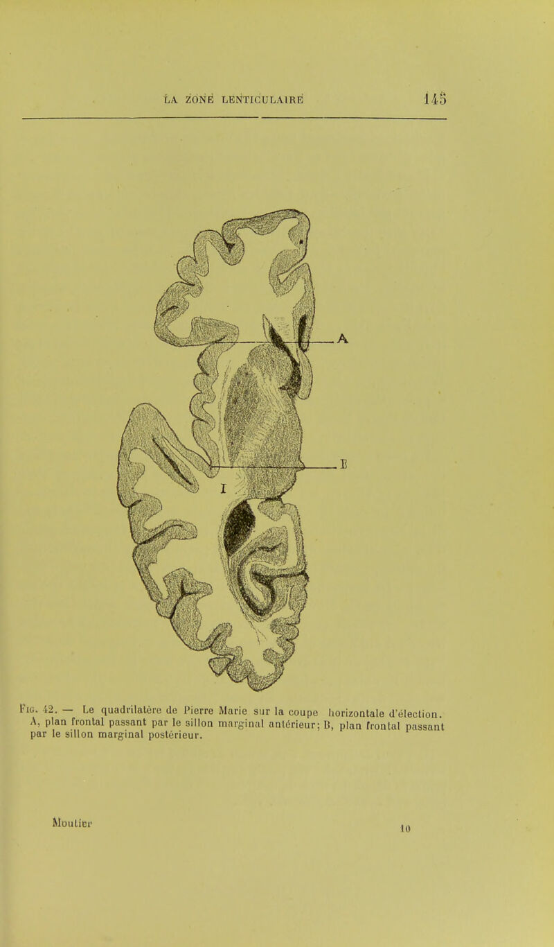 Pio. 42. — Le quadrilatère de Pierre Marie sur la coupe horizontale d'élection. A, plan frontal passant par le sillon marginal antérieur; B, plan frontal passant par le sillon marginal postérieur. Moulicr 10