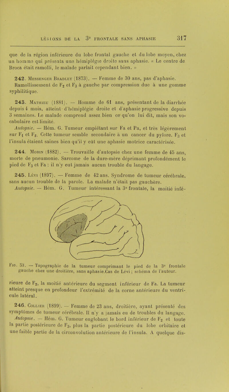 que de la région inférieure du lobe frontal gauche et du lobe moyen, chez un homme qui présenta une hémiplégie droite sans aphasie. « Le centre de Broca était ramolli, le malade parlait cependant bien. » 242. Messenger Bradley (1873). — Femme de 30 ans, pas d'aphasie. Ramollissement de F2 et F3 à gauche par compression due à une gomme syphilitique. 243. Mathieu (1881). — Homme de 61 ans, présentant de la diarrhée depuis 4 mois, atteint d'hémiplégie droite et d'aphasie progressive depuis 3 semaines. Le malade comprend assez bien ce qu'on lui dit, mais son vo- cabulaire est limité. Autopsie. — Hém. G. Tumeur empiétant sur Fa et Pa, et très légèrement sur Fi et F2. Cette tumeur semble secondaire à un cancer du pylore. F3 et l'insula étaient saines bien qu'il y eût une aphasie motrice caractérisée. 244. Morin (1882). — Trouvaille d'autopsie chez une femme de 4b' ans, morte de pneumonie. Sarcome de la dure-mère déprimant profondément le pied de F3 et Fa : il n'y eut jamais aucun trouble du langage. 245. Lévi (1897). — Femme de 42 ans. Syndrome de tumeur cérébrale, sans aucun trouble de la parole. La malade n'était pas gauchère. Autopsie. — Hém. G. Tumeur intéressant la 3e frontale, la moitié infé- Fio. 53. — Topographie de la tumeur comprimant le pied de la 3e frontale gauche chez une droitière, sans aphasie.Cas de Lévi; schéma de l'auteur. rieure de F-,, la moitié antérieure du segment inférieur de Fa. La tumeur atteint presque en profondeur l'extrémité de la corne antérieure du ventri- cule latéral. 246. Collier (1899). — Femme de 23 ans, droitière, ayant présenté des symptômes de tumeur cérébrale. II n'y a jamais eu de troubles du langage. Autopsie. — Hém. G. Tumeur englobant le bord inférieur de F2 et toute la partie postérieure de F3, plus la partie postérieure du lobe orbitaire et une faible partie de la circonvolution antérieure de l'insula. A quelque dis-