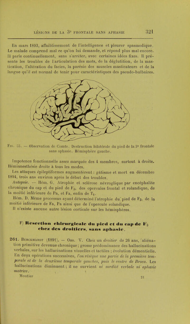 En mars 1893, affaiblissement de l'intelligence et pleurer spasmodique. Le malade comprend mal ce qu'on lui demande, et répond plus mal encore. Il parle continuellement, sans s'arrêter, avec certaines idées fixes. Il pré- sente les troubles de l'articulation des mots, de la déglutition, de la mas- tication, l'altération du faciès, la parésie des muscles masticateurs et de la langue qu'il est normal de tenir pour caractéristiques des pseudo-bulbaires. Fie. 53. — Observation de Comte. Destruction bilatérale du pied de la 3e frontale sans aphasie. Hémisphère gauche. Impotence fonctionnelle assez marquée des 4 membres, surtout à droite. Ilémianesthésie droite à tous les modes. Les attaques épileptiformes augmentèrent : gâtisme et mort en décembre 1894, trois ans environ après le début des troubles. Autopsie. — Hém. G. Atrophie et sclérose névroglique par encéphalite chronique du cap et du pied de F3, des opercules frontal et rolandique, de la moitié inférieure de Pa, et Fa, enfin de TV Hém. D. Même processus ayant déterminé l'atrophie du'pied de F3, de la moitié inférieure de Fa, Pa ainsi que de l'opercule rolandique. Il n'existe aucune autre lésion corticale sur les hémisphères. F) Résection chirurgicale du pied et du cap de F3 chez des droitiers, sans aphasie. 261. Burckhàrdt (1891). — Obs. V. Chez un droitier de 26 ans, faliéna- tion primitive devenue chronique ; grosse prédominance des hallucinations verbales, sur les hallucinations visuelles et tactiles ; évolution démentielle. En deux opérations successives, l'on résèque une partie de la première tem- porale et de la deuxième temporale gauches, puis le rentre de Broca. Les hallucinations diminuent; il ne survient ni surdité verbale ni aphasie motrice. , s Moutier <>i