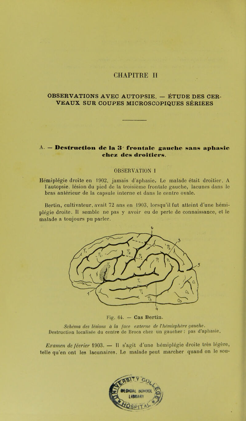 CHAPITRE II OBSERVATIONS AVEC AUTOPSIE. — ÉTUDE DES CER- VEAUX SUR COUPES MICROSCOPIQUES SÉRIÉES A. — Destruction de la 3 frontale gauche sans aphasie chez des droitiers. OBSERVATION I Hémiplégie droite en 1902, jamais d'aphasie. Le malade était droitier. A Tautopsie. lésion du pied de la troisième frontale gauche, lacunes dans le bras antérieur de la capsule interne et dans le centre ovale. Bertin, cultivateur, avait 72 ans en 1903, lorsqu'il fut atteint d'une hémi- plégie droite. Il semble ne pas y avoir eu de perte de connaissance, et le malade a toujours pu parler. Fîg. 64. — Cas Bertin. Schéma des lésions à la /ace externe de thémisphère gauche. Destruction localisé*; du centre de Broca chez un gaucher : pas d'aphasie. Examen de février 1903. — Il s'agit d'une hémiplégie droite très légère, telle qu'en ont les lacunaires. Le malade peut marcher quand on le sou-