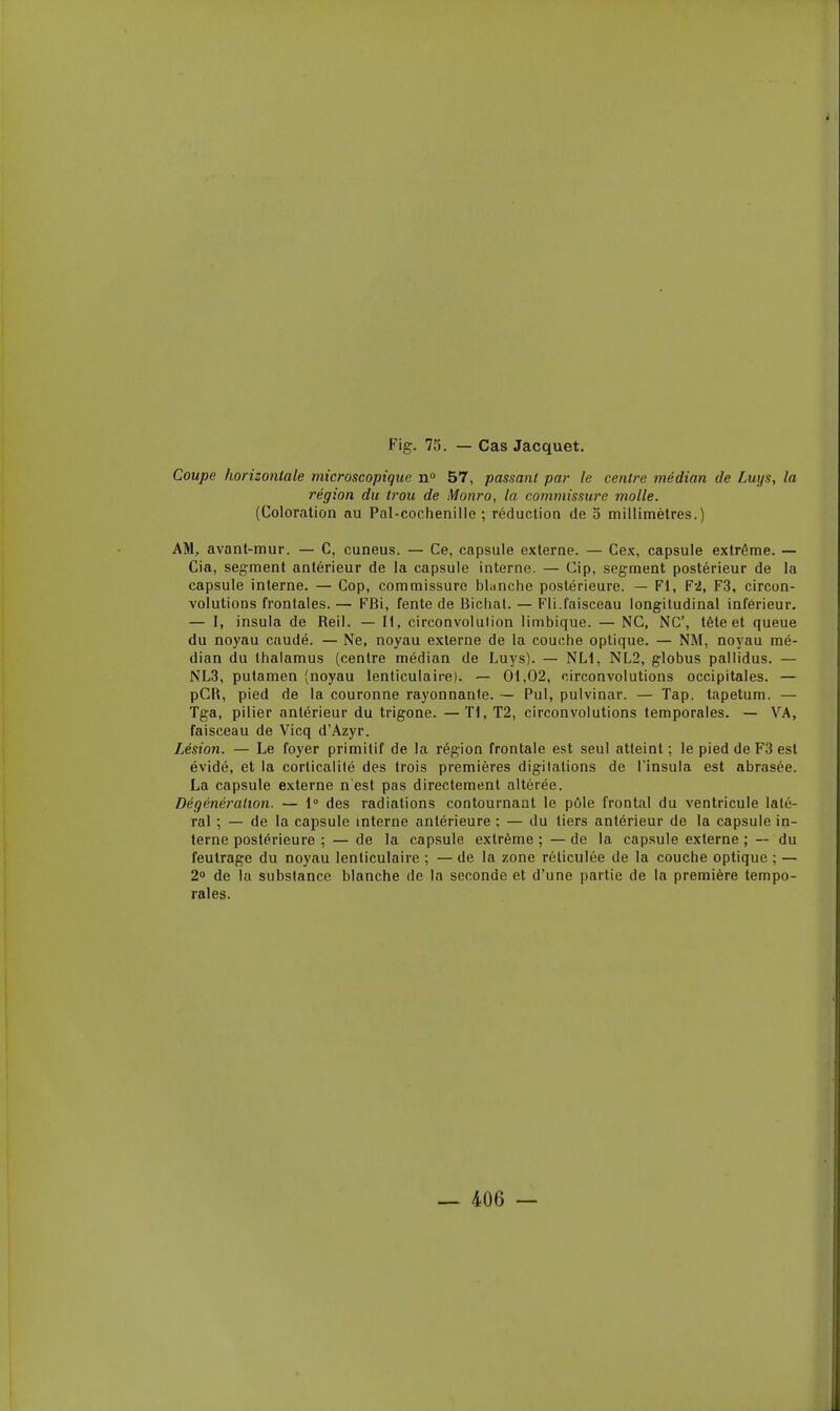 Coupe horizontale microscopique n*» 57, passant par le centre médian de Luys, la région du trou de Monro, la commissure molle. (Coloration au Pnl-cochenille ; réduction de o millimètres.) AM, avant-mur. — G, cuneus. — Ce, capsule externe. — Cex, capsule extrême. — Cia, segment antérieur de la capsule interne. — Cip, segment postérieur de la capsule interne. — Cop, commissure blanche postérieure. — Fl, F2, F.3, circon- volutions frontales. — FBi, fente de Bichal. — Fli.faisceau longitudinal inférieur. — I, insula de Reil. — II, circonvolulion limbique. — NC, NC, tête et queue du noyau caudé. — Ne, noyau externe de la couche optique. — NM, noyau mé- dian du thalamus (centre médian de Luys). — NLi, NL2, globus pallidus. — NL3, pulamen (noyau lenticulaire). — 01,02, circonvolutions occipitales. — pCR, pied de la couronne rayonnante. — Pul, pulvinar. — Tap. tapetum. — Tga, pilier antérieur du trigone. —Tl, T2, circonvolutions temporales. — VA, faisceau de Vicq d'Azyr. Lésion. — Le foyer primitif de la région frontale est seul atteint; le pied de F3 est évidé, et la corlicalilé des trois premières digilations de l'insula est abrasée. La capsule externe n'est pas directement altérée. Dégénératwn. — 1° des radiations contournant le pôle frontal du ventricule laté- ral ; — de la capsule interne antérieure ; — du tiers antérieur de la capsule in- terne postérieure ; — de la capsule extrême ; — de la capsule externe ; — du feutrage du noyau lenticulaire ; — de la zone réticulée de la couche optique ; — 2° de la substance blanche de la seconde et d'une partie de la première tempo- rales.