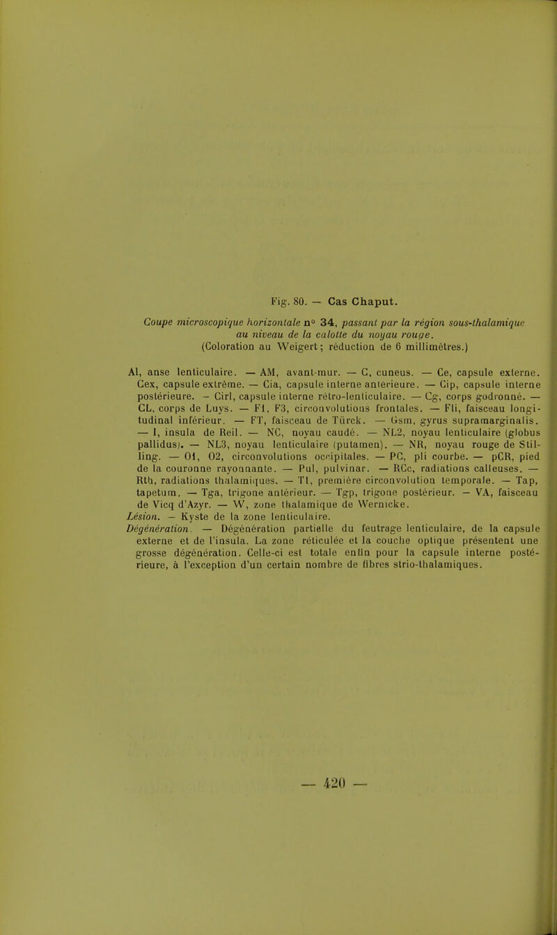 Coupe microscopique horizontale a° 34, passant par la région sous-thalamique au niveau de la calotte du noyau rouqe. (Coloration au Weigert; réduction de 6 millimètres.) Al, anse lenticulaire. — AM, avant-mur. — G, cuneus. — Ce, capsule externe. Cex, capsule extrême. — Cia, capsule interne aniérieure. — Gip, capsule interne postérieure. - Cirl, capsule interoe rétro-lenticulaire. — Cg-, corps godronné. — CL, corps de Luys. — Fl, F3, circonvolutions frontales. — Fli, faisceau longi- tudinal inférieur. — FT, faisceau de Tiirck. — Gsm, gyrus supramarginalis. — I, insula de Reil. — NC, noyau caudé. — NL2, noyau lenticulaire (globus pallidus). — NL3, noyau lenticulaire (putamen). — NR, noyau rouge de Stil- ling. — 01, 02, circonvolutions occipitales. — PC, pli courbe. — pCR, pied de la couronne rayonnante. — Pul, pulvinar. — RGc, radiations calleuses. — Rth, radiations llialarai({ues. — Tl, première circonvolution temporale. — Tap, tapetum. — Tga, trigone antérieur. — Tgp, trigone postérieur. — VA, faisceau de Vicq d'Azyr. — W, zone thalamique de Wernicke. Lésion. — Kyste de la zone lenticulaire. Dégénération. — Dégénération partielle du feutrage lenticulaire, de la capsule externe et de l'insula. La zone réticulée et la couche optique présentent une grosse dégénération. Celle-ci est totale enlln pour la capsule interne posté- rieure, à l'exception d'un certain nombre de fibres slrio-lhalamiques.