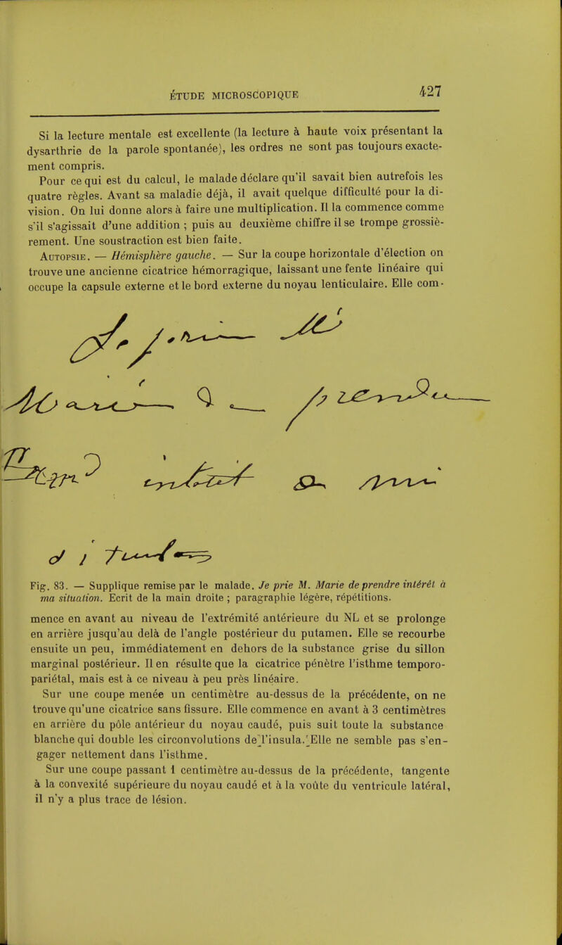 Si la lecture mentale est excellente (la lecture à haute voix présentant la dysarthrie de la parole spontanée), les ordres ne sont pas toujours exacte- ment compris. Pour ce qui est du calcul, le malade déclare qu'il savait bien autrefois les quatre règles. Avant sa maladie déjà, il avait quelque difficulté pour la di- vision. On lui donne alors à faire une multiplication. Il la commence comme s'il s'agissait d'une addition ; puis au deuxième chiffre il se trompe grossiè- rement. Une soustraction est bien faite. Autopsie. — Hémisphère gauche. — Sur la coupe horizontale d'élection on trouve une ancienne cicatrice hémorragique, laissant une fente linéaire qui occupe la capsule externe et le bord externe du noyau lenticulaire. Elle corn- Flg. 83. — Supplique remise par le malade. Je prie M. Marie de prendre intérêt à ma situation. Ecrit de la main droite ; paragraphie légère, répétitions. mence en avant au niveau de l'extrémité antérieure du NL et se prolonge en arrière jusqu'au delà de l'angle postérieur du putamen. Elle se recourbe ensuite un peu, immédiatement en dehors de la substance grise du sillon marginal postérieur. Il en résulte que la cicatrice pénètre l'isthme temporo- pariétal, mais est à ce niveau à peu près linéaire. Sur une coupe menée un centimètre au-dessus de la précédente, on ne trouve qu'une cicatrice sans fissure. Elle commence en avant à 3 centimètres en arrière du pôle antérieur du noyau caudé, puis suit toute la substance blanche qui double les circonvolutions del'insula.^EUe ne semble pas s'en- gager nettement dans l'isthme. Sur une coupe passant 1 centimètre au-dessus de la précédente, tangente à la convexité supérieure du noyau caudé et à la voûte du ventricule latéral, il n'y a plus trace de lésion.