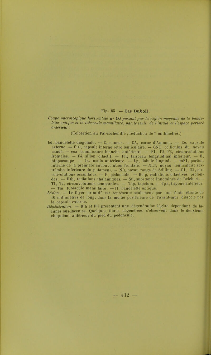 Coupe microscopique horizontale n» 16 passant par la région moyenne de la bande- lette optique et le tubercule maniillaire, par le seuil de l'insula et l'espace perforé antérieur. (Coloration au Pal-cochenille; réduction de 7 millimètres.) bd, bandelette diagonale. — C, cuneus. — CA, corne d'Ammon. — Ce, capsule externe. — Cirl, capsule interne rétro lenticulaire. — CNC, colliculus du noyau caudé. — coa, commissure blanche antérieure — Fl, F2, F.3, circonvolutions frontales. — F4, sillon olfactif. — Fli, faisceau longitudinal inférieur. — H, hippocampe. — la. insula anlérieui'e. — Lg, lobule lingual. — mFl, portion interne de la première circonvolution frontale. — NL3, noyau lenticulaire (ex- trémité inférieure du putamen). — NR, noyau rouge de Stilling. — 01, 02, cir- convolutions occipitales. — P, pédoncule — Rolp, radiations olfactives profon- des. — Rth, radiations thalamiques. — Sti, substance innominée de Reichert.— Tl, T2, circonvolutions temporales. — Tap, tapetum. — Tga, trigone antérieur. — Tm, tubercule mamillaire. — II, bandelette optique. Lésion. — Le foyer primitif est représenté seulement par une fente étroite de 10 millimètres de long, dans la moitié postérieure de Tavant-mur dissocié par la capsule externe. Défjénéralion. — Rlh et Fli présentent une dégénération légère dépendant de la- cunes sus-jacenles. Quelques fibres dégénérées s'observent dans le deuxième cinquième antérieur du pied du pédoncule.