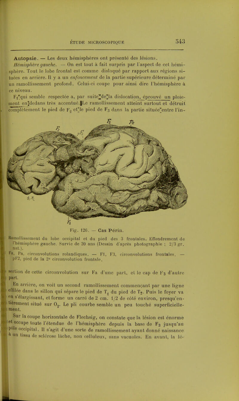 Autopsie. — Les deux hémisphères ont présenté des lésions. Hémisphère gauche. — On est tout à fait surpris par l'aspect de cet hémi- sphère. Tout le lobe frontal est comme disloqué par rapport aux régions si- tuées en arrière. Il y a un enfoncement de la partie supérieure déterminé par un ramollissement profond. Celui-ci coupe pour ainsi dire l'hémisphère à ce niveau. Fi'qui semble respectée a, par suite'de'Ia dislocation, éprouvé un ploie- ment en]dedans très accentué.jLe ramollissement atteint surtout et détruit complètement le pied de et'le pied de F3 dans la partie située'entre l'in- Fig. 126. — Cas Périn. Ramollissement du lobe occipital et du pied des 3 frontales. Effondrement de rhémisphère gauche. Survie de 20 ans (Dessin d'après photographie ; 2/3 gr. nat.). Pa, Pa. circonvolutions rolandiques. — Fl, F3, circonvolutions frontales. — pF2, pied de la 2» circonvolution frontale. sertion de cette circonvolution sur Fa d'une part, et le cap de F3 d'autre part. En arrière, on voit un second ramollissement commençant par une ligne effilée dans le sillon qui sépare le pied de du pied de T2. Puis le foyer va en s'élargissant, et forme un carré de 2 cm. 1/2 de côté environ, presqu'en- itièrement situé sur O,. Le pli courbe semble un peu touché superficielle- iment. Sur la coupe horizontale de Flechsig, on constate que la lésion est énorme •et occupe toute l'étendue de l'hémisphère depuis la base de F3 jusqu'au ^Pôle occipital. Il s'agit d'une sorte de ramollissement ayant donné naissance a un tissu de sclérose lâche, non celluleux, sans vacuoles. En avant, la lé-