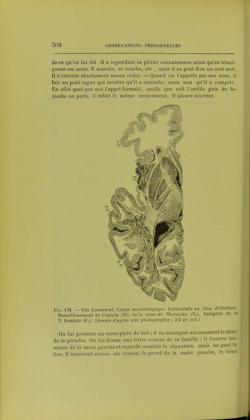 de ce qu'on lui dit. 11 a cependant sa pleine connaissance ainsi qu'en témoi- gnent ses actes. Il marche, se couche, etc., mais il ne peut dire un seul mot. Il n'exécute absolument aucun ordre. —Quand on l'appelle par son nom, il fait un petit signe qui montre qu'il a entendu, mais non qu'il a compris. En effet quel que soit l'appel formulé, quelle que soit l'oreille près de la- quelle on parle, il refait le même mouvement. Il pleure souvent. FiG. 134. — Cas Lnurcncei. Coupe macroscopique liorizonlale au lieu d'éleclion. Ramollissement de l'insula (IH), (loin zone do Wernicke (Ti). Intégrité de la 3 frontale (F3). (Dessin d'npros une pholograpliie ; 3/4 gr.nat.) On lui présente un verre plein do lait ; il ne témoigne aucunement le désir do le prendre. On lui donne une lettre venant de sa famille : il l'ouvre lui- môme de la main gauche et regarde aussitôt la signature, mais ne peut la lire. Il reconnaît encore un crayon, le prend de la main gauche, le lient