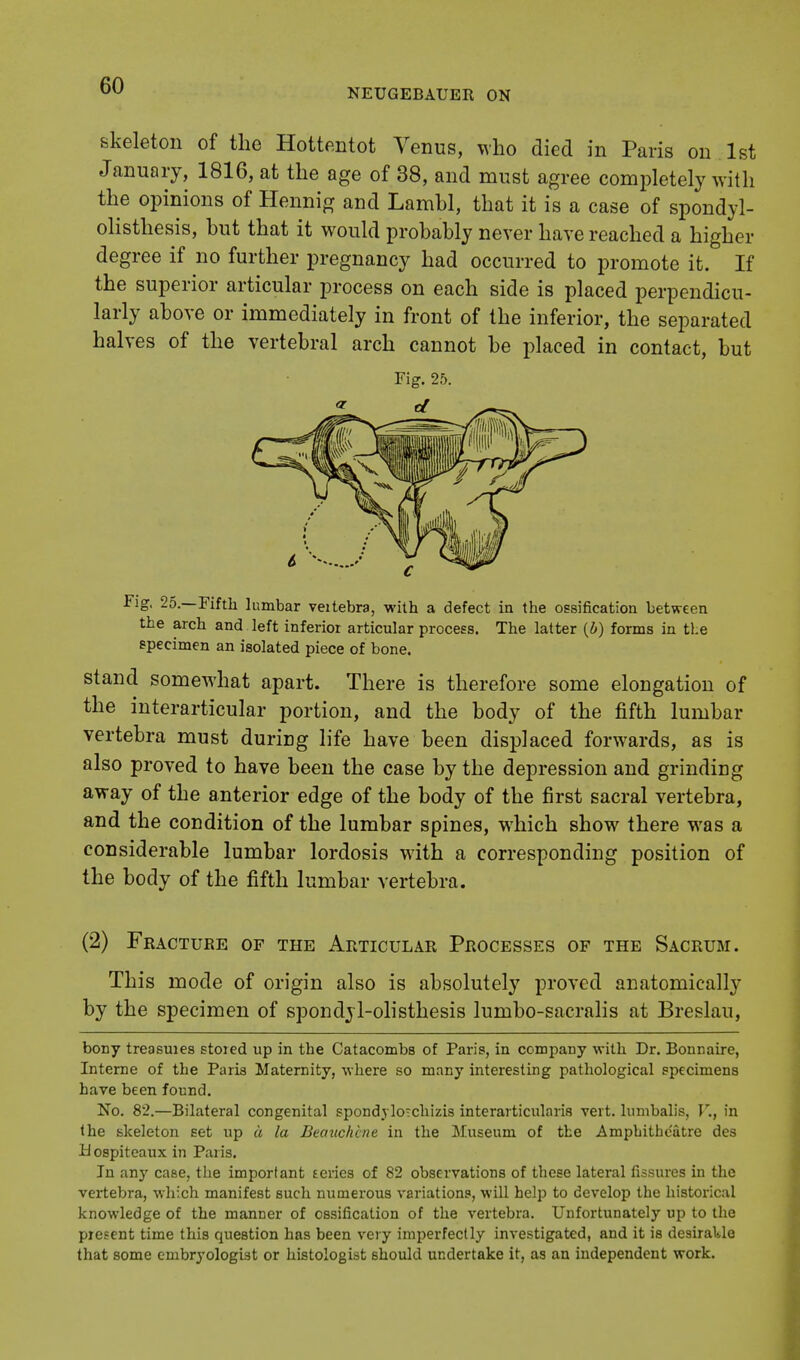 NEUGEBAUEIt ON skeleton of the Hottentot Venus, who died in Paris on 1st January, 1816, at the age of 38, and must agree completely with the opinions of Hennig and Lamhl, that it is a case of spondyl- olisthesis, hut that it would probably never have reached a higher degree if no further pregnancy had occurred to promote it. If the superior articular process on each side is placed perpendicu- larly above or immediately in front of the inferior, the separated halves of the vertebral arch cannot be placed in contact, but Fig. 25. Fig. 25.—Fifth lumbar veitebra, with a defect in the ossification between the arch and . left inferior articular process. The latter (i) forms in tl.e specimen an isolated piece of bone. stand somewhat apart. There is therefore some elongation of the interarticular portion, and the body of the fifth lumbar vertebra must during life have been displaced forwards, as is also proved to have been the case by the depression and grinding away of the anterior edge of the body of the first sacral vertebra, and the condition of the lumbar spines, wrhich show there was a considerable lumbar lordosis with a corresponding position of the body of the fifth lumbar vertebra. (2) Fracture of the Articular Processes of the Sacrum. This mode of origin also is absolutely proved anatomically by the specimen of spondylolisthesis lumbo-sacralis at Breslau, bony treasuies stored up in the Catacombs of Paris, in company with Dr. Bonnaire, Interne of the Paris Maternity, where so many interesting pathological specimens have been found. No. 82.—Bilateral congenital spondylotchizis interarticularis vert, lumbalis, V., in the skeleton Eet up a la Beauchcne in the Museum of the Amphitheatre des Hospiteaux in Paris. In any case, the important series of 82 observations of these lateral fissures in the vertebra, which manifest such numerous variations, will help to develop the historical knowledge of the maimer of ossification of the vertebra. Unfortunately up to the present time this question has been very imperfectly investigated, and it is desiraUe that some embryologist or histologist should undertake it, as an independent work.