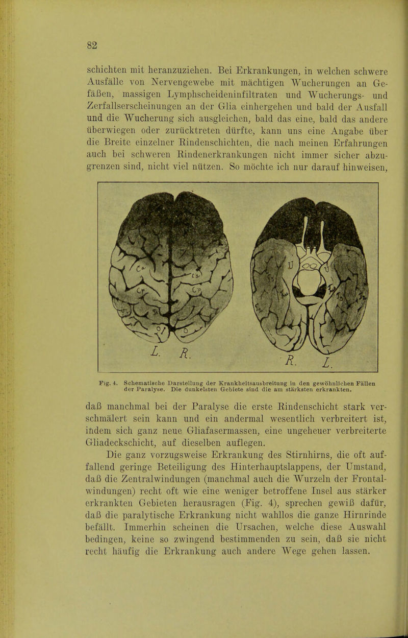 scliichten mit heranzuziehen. Bei Erkrankungen, in welchen schvvere Ausfallc von Nervengewebe mit machtigen Wucherungen an Ge- faBen, massigen Lymphscheideninfiltraten und Wucherungs- und Zerfallserscheinungen an der Glia einhergehen nnd bald der Ansfall und die Wucherung sich ausgleichcn, bald das eine, bald das anderc iiberwiegen oder zurucktreten durfte, kann uns eine Angabe iiber die Breitc einzelner Bindenschichten, die nach mcinen Erfahrungen auch bei schweren Rindenerkrankungen nicht immer sicher abzu- grenzen sind, nicht viel niitzen. So mochte ich nur darauf hinweisen, Fig. 4. Scbematigcbc Darstelluug der Krankbeitsausbreitung in den gewbhnlicben Fallen der Paralyse. Die dunkelsten Gebiete sind die am starksten erkrankten. daB manchmal bei der Paralyse die erste Rindenschicht stark ver- schmalert sein kann und ein andermal wesentlich verbreitert ist, indem sich ganz neue Gliafasermassen, eine ungeheuer verbreiterte Gliadeckschicht, auf dieselben auflegen. Die ganz vorzugsweise Erkrankung des Stirnhirns, die oft auf- fallend geringe Beteiligung des Hinterhauptslappens, der Umstand, daB die Zentralwindungen (manchmal audi die Wurzeln der Frontal windungen) recht oft wie eine weniger betroffene Insel aus starker erkrankten Gebieten herausragen (Fig. 4), sprechen gewiB dafiir, daB die paralytische Erkrankung nicht wahllos die ganze Hirnrinde befallt. Immerhin scheincn die Ursachen, welche diese Aus\v;ihl bedingen, keine so zwingend bestimmenden zu sein, daB sie nicht recht haufig die Erkrankung auch andere Wegc gehen lassen.