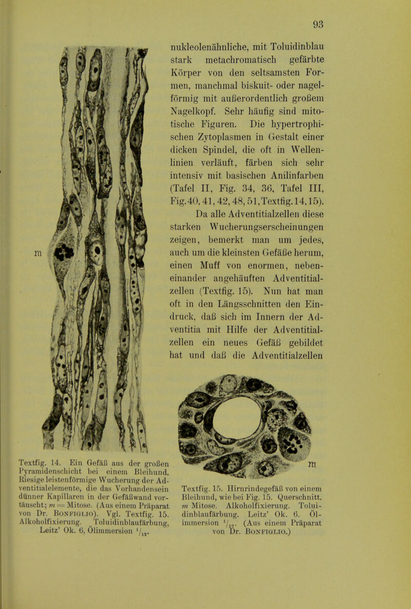 Textfig. 14. Ein GefaB aus der groBen Pyramidenschicht bei einem Bleihund. Riesige leistenformige Wucherung der Ad- ventitialelemente, die das Vorhandensein diinner Kapillaren in der GefaBwand vor- tauscht; m = Mitose. (Aus einem Praparat von Dr. Bonfigijo). Vgl. Textfig. 15. Alkoholfixierung. Toluidinblauf'arbung, Leitz* Ok. 6, Olimmersion l/u. nukleolenahnliche, mit Toluidinblau stark metachromatisch gefarbte Korper von den seltsamsten For- men, raanchmal biskuit- oder nagel- formig mit aufierordentlich grofiem Nagelkopf. Sehr Mufig sind mito- tische Figuren. Die hypertrophi- schen Zytoplasmen in Gestalt einer dicken Spindel, die oft in Wellen- linien verlauft, farben sich sehr intensiv mit basischen Anilinfarben (Tafel II, Fig. 34, 36, Tafel III, Fig. 40,41,42,48,51, Textfig. 14,15). Da alle Adventitialzellen diese starken Wucherungserscheinungen zeigen, bemerkt man urn jedes, auch um die kleinsten GefaBe herum, einen Muff von enormen, neben- einander angehauften Adventitial- zellen (Textfig. 15). Nun hat man oft in den Langsschnitten den Ein- druck, daG sich im Innern der Ad- ventitia mit Hilfe der Adventitial- zellen ein neues GefaB gebildet hat und dafi die Adventitialzellen Textfig. 15. IlirnrindegefaB von einem Bleihund, wie bei Fig. 15. Querscbnitt. m Mitose. Alkoholfixierung. Tolui- dinblaufarbung. Leitz' Ok. 6. Ol- immersion x/i2- (Aus einem Praparat von Dr. Bonfiglio.)