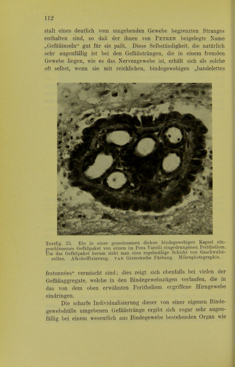 stalt ernes cleutlich vom umgebenden Gewebe begrenzten Stranges enthalten sind, so daB der ihnen von Petren beigelegte Name „GefaBinseln gut fur sie pafit. Diese Selbstandigkeit, die naturlich sehr augenfallig ist bei den GefaBstrangen, die in einem fremden Gewebe liegen, wie es das Nervengewebe ist, erhalt sich als solche oft selbst, wenn sie mit reichlichen, bindegewebigen „bandelettes Textfig. 23. Ein in einer gemeinsamen dicken bindegewebigen Kapsel ein- geschlossenes GefiiBpaket von einem im Pons Varolii eingedrungenen Peritheliom. Urn das GefaBpaket bernm sieht man eine regelmaBige Schicht von Geschwnlst- zellen. Alkobolfixierung. van GiESONsche Farbung. Mikrophotographie. festonnees vermischt sind; dies zeigt sich ebenfalls bei vielen der Gefafiaggregate, welclie in den Bindegewebsziigen verlaufen, die in das von dem oben erwalmten Peritheliom ergriffene Hirngewebe ein drin gen. Die scharfe Indiviclualisierung dieser von einer eigenen Binde- gewebshiille umgebenen Gefafistrange ergibt sich sogar sehr augen- fallig bei einem wesentlich aus Bindegewebe bestehenden Organ wie