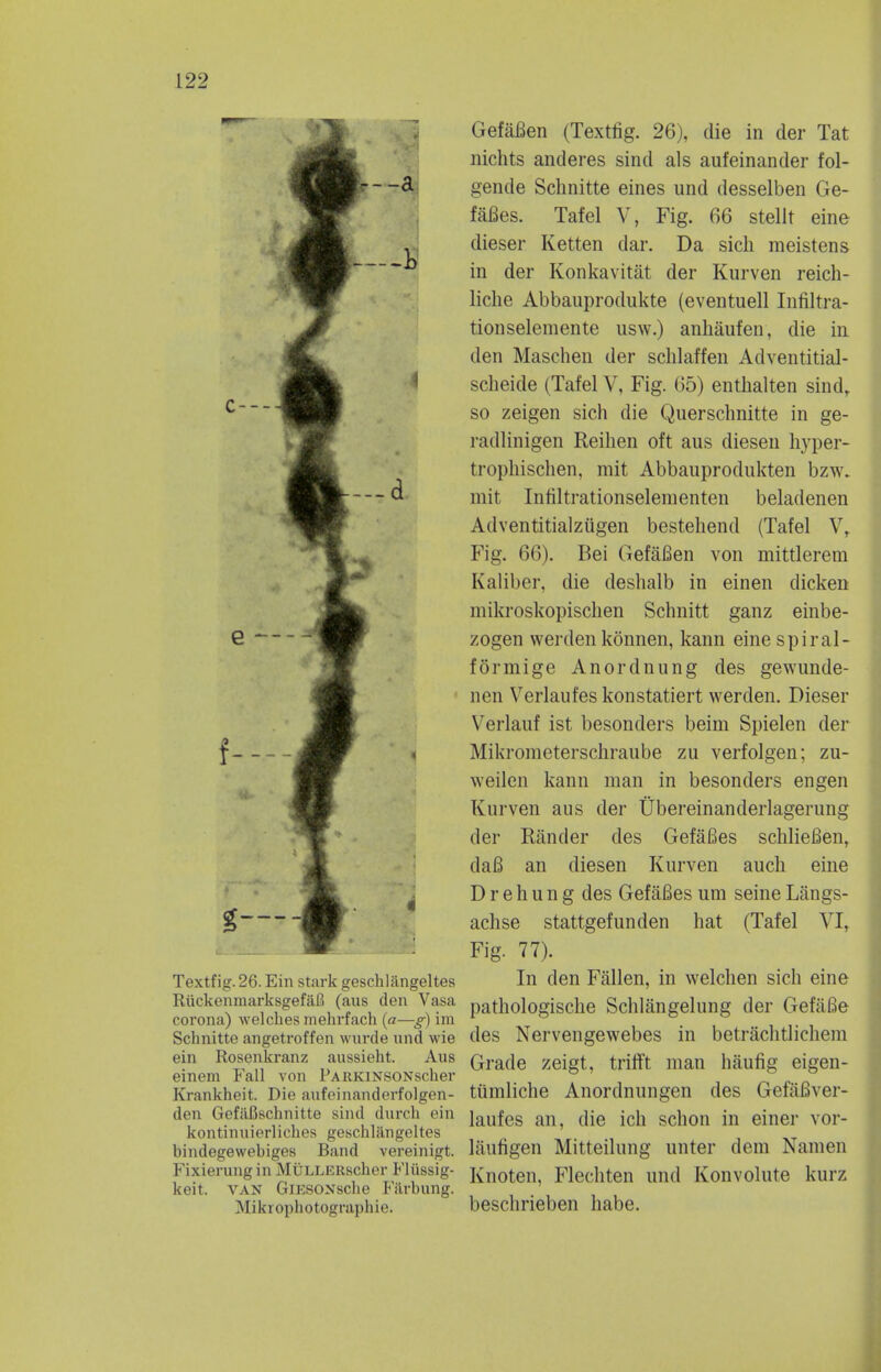 --a c- G — f-—■ g— -I Textfig. 26. Ein stark geschliingeltes RuckenmarksgefaB (aus den Vasa corona) welches mehrfach (a—g) im Schnitte angetroffen wnrde und wie ein Rosenkranz aussieht. Aus einem Fall von PARKiNSONscher Krankheit. Die aufeinanderfolgen- den Gefafischnitte sind (lurch ein kontinuierliches geschlangeltes hindegewehiges Band vereinigt. Fixierung in MuLLERscher Fliissig- keit. van GiESONsche Filrhung. Mikrophotographie. GefaBen (Textfig. 26), die in der Tat nichts anderes sind als aufeinander fol- gende Schnitte eines und desselben Ge- faBes. Tafel V, Fig. 66 stellt eine dieser Ketten dar. Da sich meistens in der Konkavitat der Kurven reich- liche Abbauprodukte (eventuell Infiltra- tionselemente usw.) anhaufen, die in den Maschen der schlaffen Adventitial- scheide (Tafel V, Fig. 65) enthalten sindr so zeigen sich die Querschnitte in ge- radlinigen Reihen oft aus diesen hyper- trophischen, mit Abbauprodukten bzw. mit Infiltrationselementen beladenen Adventitialziigen bestehend (Tafel V, Fig. 66). Bei GefaBen von mittlerem Kaliber. die deshalb in einen dicken niikroskopischen Schnitt ganz einbe- zogen werden konnen, kann eine spiral- formige Anordnung des gewunde- nen Verlanfeskonstatiert werden. Dieser Verlauf ist besonders beim Spielen der Mikrometerschraube zu verfolgen; zu- weilen kann man in besonders engen Kurven aus der Ubereinanderlagerung der Rander des GefaBes schlieBen, daB an diesen Kurven audi eine D r e h u n g des GefaBes una seine Langs- achse stattgefunden hat (Tafel VIr Fig. 77). In den Fallen, in welchen sich eine pathologische Schlangelung der GefiiBe des Nervengewebes in betrachtlichem Grade zeigt, trifft man haufig eigen- tiimliche Anordnungen des GefaBver- laufes an, die ich schon in einer vor- laufigen Mitteilung unter dem Namen Knoten, Flechten und Konvolute kurz beschrieben habe.