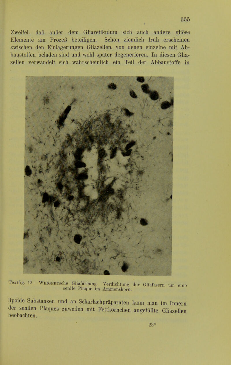 » Zweife], daB auBer dem Gliaretikulum sich auch andere gliose Elemente am ProzeB beteiligen. Schon ziemlich friih erscheinen zwischen den Einlagerungen Gliazellen, von denen einzelne mit Ab- baustoffen beladen sind und wohl spater degenerieren. In diesen Glia- zellen verwandelt sich wahrscheinlich ein Teil der Abbaustoffe in Textfig. 12. WEiGERTsche Gliafarbung. Verdichtung der Gliafasern urn eine senile Plaque im Ammonshorn. lipoide Substanzen und an Scharlaclipraparaten kann man im Innern der senilen Plaques zuweilen mit Fettkornclien angefullte Gliazellen beobachten. 23*