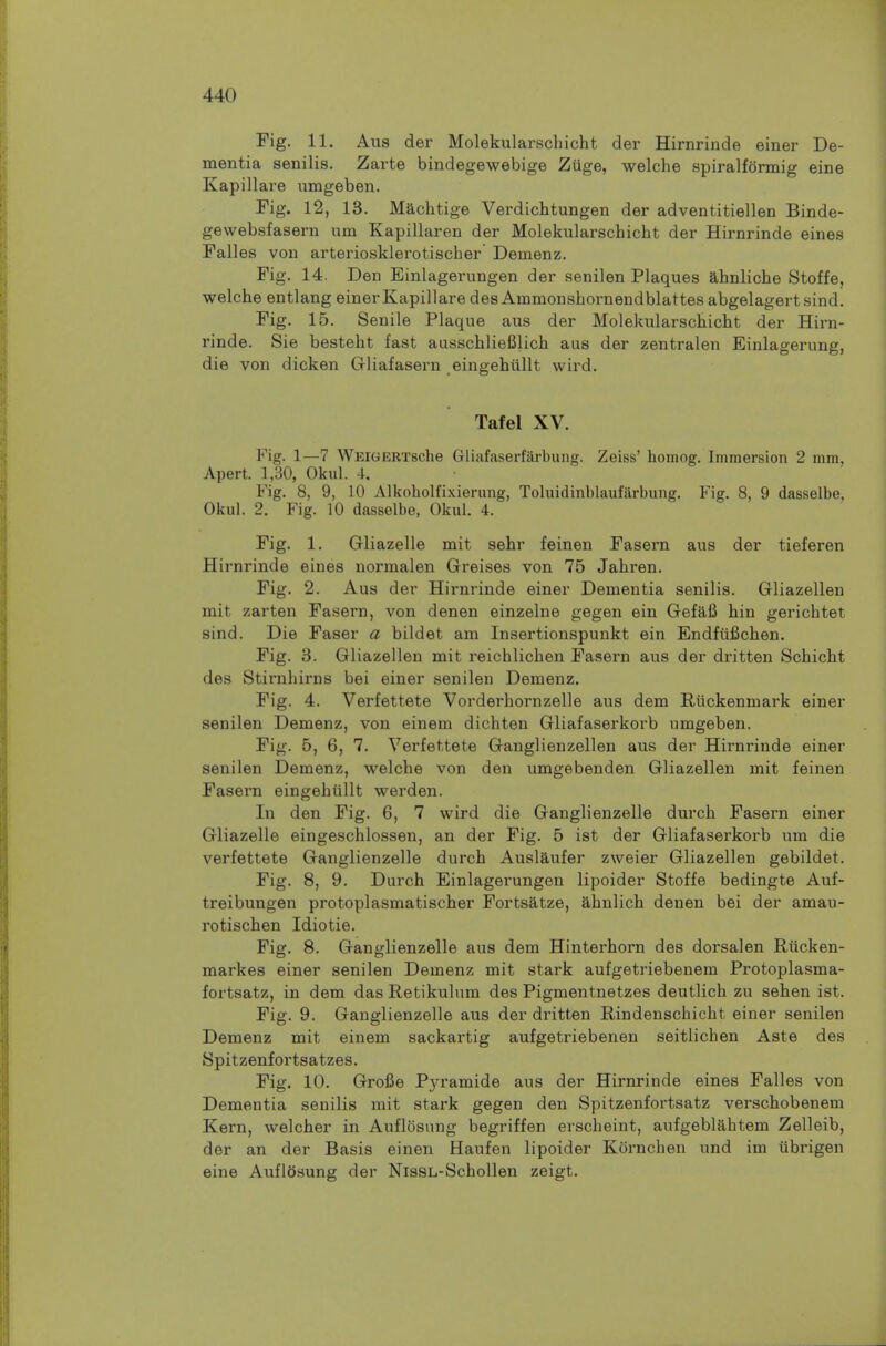 Fig. 11. Aus der Molekularschicht der Hirnrinde einer De- mentia senilis. Zarte bindegewebige Zuge, welche spiralfonnig eine Kapillare umgeben. Fig. 12, 13. Machtige Verdichtungen der adventitiellen Binde- gevvebsfasern um Kapillaren der Molekularschicht der Hirnrinde eines Falles von arteriosklerotischer Demenz. Fig, 14. Den Einlagerungen der senilen Plaques ahnliche Stoffe, welche entlang einer Kapillare des Ammonshornendblattesabgelagertsind. Fig. 15. Senile Plaque aus der Molekularschicht der Hirn- rinde. Sie besteht fast ausschliefilich aus der zentralen Einlagerung, die von dicken Gliafasern eingehiillt wird. Tafel XV. Fig. 1—7 WElGERTsche Gliafaserfarbung. Zeiss' homog. Immersion 2 mm, Apert. 1,30, Okul. 4. Fig. 8, 9, 10 Alkoholfixierung, Toluidinblaufarbung. Fig. 8, 9 dasselbe, Okul. 2. Fig. 10 dasselbe, Okul. 4. Fig. 1. Gliazelle mit sehr feinen Fasern aus der tieferen Hirnrinde eines normalen Gi'eises von 75 Jahren. Fig. 2. Aus der Hirnrinde einer Dementia senilis. Gliazellen mit zarten Fasern, von denen einzelne gegen ein Gefafi hin gerichtet sind. Die Faser a bildet am Insertionspunkt ein Endfiifichen. Fig. 3. Gliazellen mit reichlichen Fasern aus der dritten Schicht des Stirnhirns bei einer senilen Demenz. Fig. 4. Verfettete Vorderhornzelle aus dem Riickenmark einer senilen Demenz, von einem dichten Gliafaserkorb umgeben. Fig. 5, 6, 7. Verfettete Ganglienzellen aus der Hirnrinde einer senilen Demenz, welche von den umgebenden Gliazellen mit feinen Fasern eingehiillt werden. In den Fig. 6, 7 wird die Ganglienzelle durch Fasern einer Gliazelle eingeschlossen, an der Fig. 5 ist der Gliafaserkorb um die verfettete Ganglienzelle durch Auslaufer zweier Gliazellen gebildet. Fig. 8, 9. Durch Einlagerungen lipoider Stoffe bedingte Auf- treibungen protoplasmatischer Fortsatze, ahnlich denen bei der amau- rotischen Idiotie. Fig. 8. Ganglienzelle aus dem Hinterhorn des dorsalen Riicken- markes einer senilen Demenz mit stark aufgetriebenem Protoplasma- fortsatz, in dem das Retikulum des Pigmentnetzes deutlich zu sehen ist. Fig. 9. Ganglienzelle aus der dritten Rindenschicht einer senilen Demenz mit einem sackartig aufgetriebenen seitlichen Aste des Spitzenfortsatzes. Fig. 10. Grofie Pyramide aus der Hirnrinde eines Falles von Dementia senilis mit stark gegen den Spitzenfortsatz verschobenem Kern, welcher in Auflosung begriffen erscheint, aufgeblahtem Zelleib, der an der Basis einen Haufen lipoider Kornchen und im ubrigen eine Auflosung der NisSL-Schollen zeigt.