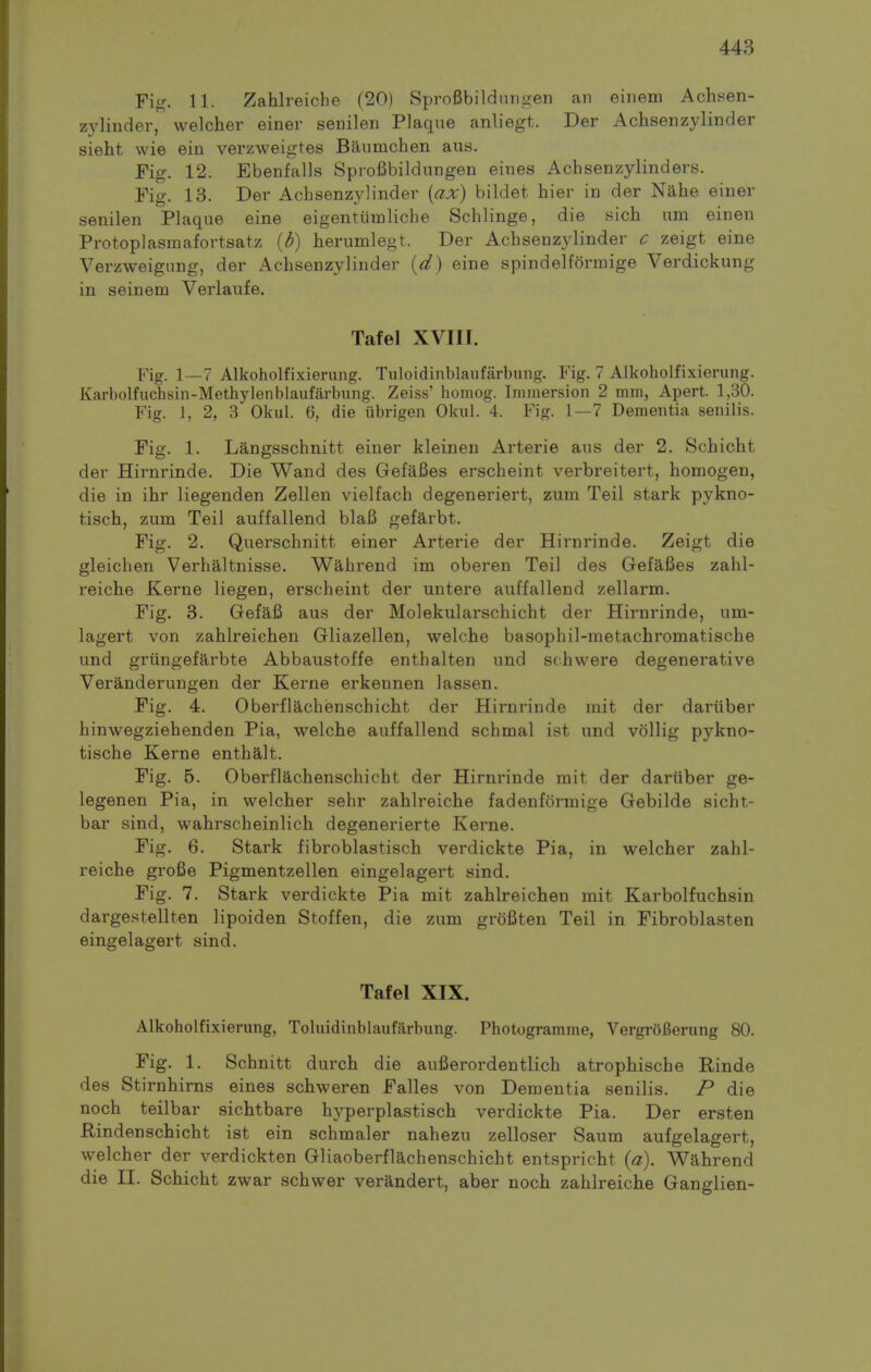 Fi^. 11. Zahlreiche (20) Sprofibildmigen an einem Achsen- zylinder, welcher einer senilen Plaque anliegt. Der Achsenzylinder sieht wie ein verzweigtes Baumchen aus. Fig. 12. Ebenfalls Sprofibildungen eines Achsenzylinders. Fig. 13. Der Achsenzylinder {ax) bildet hier in der Nahe einer senilen Plaque eine eigentiimliche Schlinge, die sich urn einen Protoplasmafortsatz (d) herumlegt. Der Achsenzylinder c zeigt eine Verzweignng, der Achsenzylinder {d) eine spindelformige Verdickung in seinem Verlaufe. Tafel XVIII. Fig. 1—7 Alkoholfixierung. Tuloidinblaufarbung. Fig. 7 Alkoholfixierung. Karbolfuchsin-Methylenblaufarbung. Zeiss' homog. Immersion 2 mm, Apart. 1,30. Fig. 1, 2, 3 Okub 6, die iibrigen OkuL 4. Fig. 1—7 Dementia senilis. Fig. 1. Langsschnitt einer kleinen Arterie aus der 2. Schicht der Hirnrinde. Die Wand des GefaBes erscheint verbreitert, homogen, die in ihr liegenden Zellen vielfach degeneriert, zum Teil stark pykno- tisch, zum Teil auffallend blaB gefarbt. Fig. 2. Querschnitt einer Arterie der Hirnrinde. Zeigt die gleichen Verhaltnisse. Wahrend im oberen Teil des GefaBes zahl- reiche Kerne liegen, erscheint der untere auffallend zellarm. Fig. 3. Gefafi aus der Molekularschicht der Hirnrinde, um- lagert von zahlreichen Gliazellen, welche basophil-metachromatische und griingefarbte Abbaustoffe enthalten und schwere degenerative Veranderungen der Kerne erkennen lassen. Fig. 4. Oberflachenschicht der Hirnrinde mit der dariiber hinwegziehenden Pia, welche auffallend schmal ist und vollig pykno- tische Kerne enthalt. Fig. 5. Oberflachenschicht der Hirnrinde mit der dariiber ge- legenen Pia, in welcher sehr zahlreiche fadenforraige Gebilde sicht- bar sind, wahrscheinlich degenerierte Kerne. Fig. 6. Stark fibroblastisch verdickte Pia, in welcher zahl- reiche groBe Pigmentzellen eingelagert sind. Fig. 7. Stark verdickte Pia mit zahlreichen mit Karbolfuchsin dargestellten lipoiden Stoffen, die zum grofiten Teil in Fibroblasten eingelagert sind. Tafel XIX. Alkoholfixierung, Toluidinblaufiirbung. Photogramme, VergroBerung 80. Fig. 1. Schnitt durch die auBerordentlich atrophische Rinde des Stirnhirns eines schweren Falles von Dementia senilis. P die noch teilbar sichtbare hj^perplastisch verdickte Pia. Der ersten Rindenschicht ist ein schmaler nahezu zelloser Saum aufgelagert, welcher der verdickten Gliaoberflachenschicht entspricht (a). Wahrend die II. Schicht zwar schwer verandert, aber noch zahlreiche Ganglien-