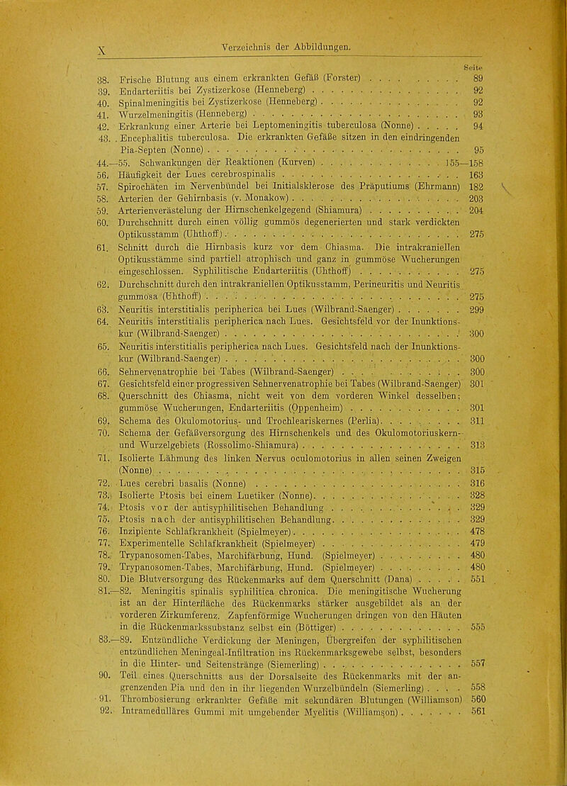 Seite 38. Friscke Blutung aus einem erkrankten GefaB (Forster) 89 39. Endarteritis bei Zystizerkose (Henneberg) 92 40. Spinalmeningitis bei Zystizerkose (Henneberg) 92 41. Wurzelmeningitis (Henneberg) 93 42. Erkrankung einer Arterie bei Leptomeningitis tuberculosa (Nonne) 94 43. . Encephalitis tuberculosa. Die erkrankten GefaBe sitzen in den eindringenden Pia-Septen (Nonne) 95 44—55. Schwankungen der Reaktionen (Kurven) 155—158 56. Haufigkeit der Lues cerebrospinalis 163 57. Spirockaten im Nervenbimdel bei Initialsklerose des Praputiums (Ehrmann) 182 58. Arterien der Gehirnbasis (v. Monakow) 203 59. Arterienverastelung der Himschenkelgegend (Shiamura) 204 60. Durchschnitt durch einen vollig gummos degenerierten und stark verdickten Optikusstamm (Uhithoff) .• . 275 61. Schnitt durch die Hirnbasis kurz vor dem Chiasma. Die intrakraniellen Optikusstamme sind partiell atrophisch und ganz in gummose Wucherungen eingeschlossen. Syphilitische Endarteriitis (Uhthoffj 275 62. Durchschnitt durch den intrakraniellen Optikusstamm, Perineuritis und Neuritis gummosa (Uhthoff) . . . . . ....... . 275 63. Neuritis interstitialis peripherica bei Lues (Wilbrand-Saenger) 299 64. Neuritis interstitialis peripherica nach Lues. Gesichtsfeld vor der Inunktions- kur (Wilbrand-Saenger) 300 65. Neuritis interstitialis peripherica nach Lues. Gesichtsfeld nach der Inunktions- kur (Wilbrand-Saenger) 300 66. Sehnervenatrophie bei Tabes (Wilbrand-Saenger) .... 300 67. Gesichtsfeld einer progressiven Sehnervenatrophie bei Tabes (Wilbrand-Saenger) 301 68. Querschnitt des Chiasma, nicht weit von dem vorderen Winkel desselben; gummose Wucherungen, Endarteriitis (Oppenheim) 301 69. Schema des Okulomotorius- und Trochleariskernes (Perlia). ........ 311 70. Schema der GefaBversorgung des Hirnschenkels und des Okulomotoriuskern- und Wurzelgebiets (Rossolimo-Skiamura) 313 71. Isolierte Lahmung des linken Nervus oculomotorius in alien seinen Zweigen (Nonne). . 315 72. Lues cerebri basalis (Nonne) 316 73. Isolierte Ptosis bei einem Luetiker (Nonne) 328 74. Ptosis vor der antisyphilitischen Behandlung 329 75. Ptosis nach der antisyphilitischen Behandlung 329 76. Inzipiente Schlafkrankheit (Spielmeyer) 478 77. Experimented Schlafkrankheit (Spielmeyer) 479 78. Trypanosomen-Tabes, Marchifarbung, Hund. (Spielmeyer) ......... 480 79.. Trypanosomen-Tabes, Marchifarbung, Hund. (Spielmeyer) 480 80. Die Blutversorgung des Ruckenmarks auf dem Querschnitt (Dana) 551 81. —82. Meningitis spinalis syphilitica chronica. Die meningitische Wucherung ist an der Hinterflache des Ruckenmarks starker ausgebildet als an der vorderen Zirkumferenz. Zapfenformige Wucherungen dringen von den Hauten in die Riickenmarkssubstanz selbst ein (Bottiger) 555 83.-89. Entziindliche Verdickung der Meningen, Ubergreifen der syphilitischen entziindlichen Meningeal-Infiltration ins Riickenmarksgewebe selbst, besonders in die Hinter- und Seitenstrange (Siemerling) 557 90. Teil eines Querschnitts aus der Dorsalseite des Ruckenmarks mit der an- grenzenden Pia und den in ihr liegenden Wurzelbundeln (Siemerling) .... 558 ■ 91. Thrombosierung erkrankter GefaBe mit sekundaren Blutungen (Williamson) 560 92. Intramedullares Gummi mit umgebender Myelitis (Williamson) 561